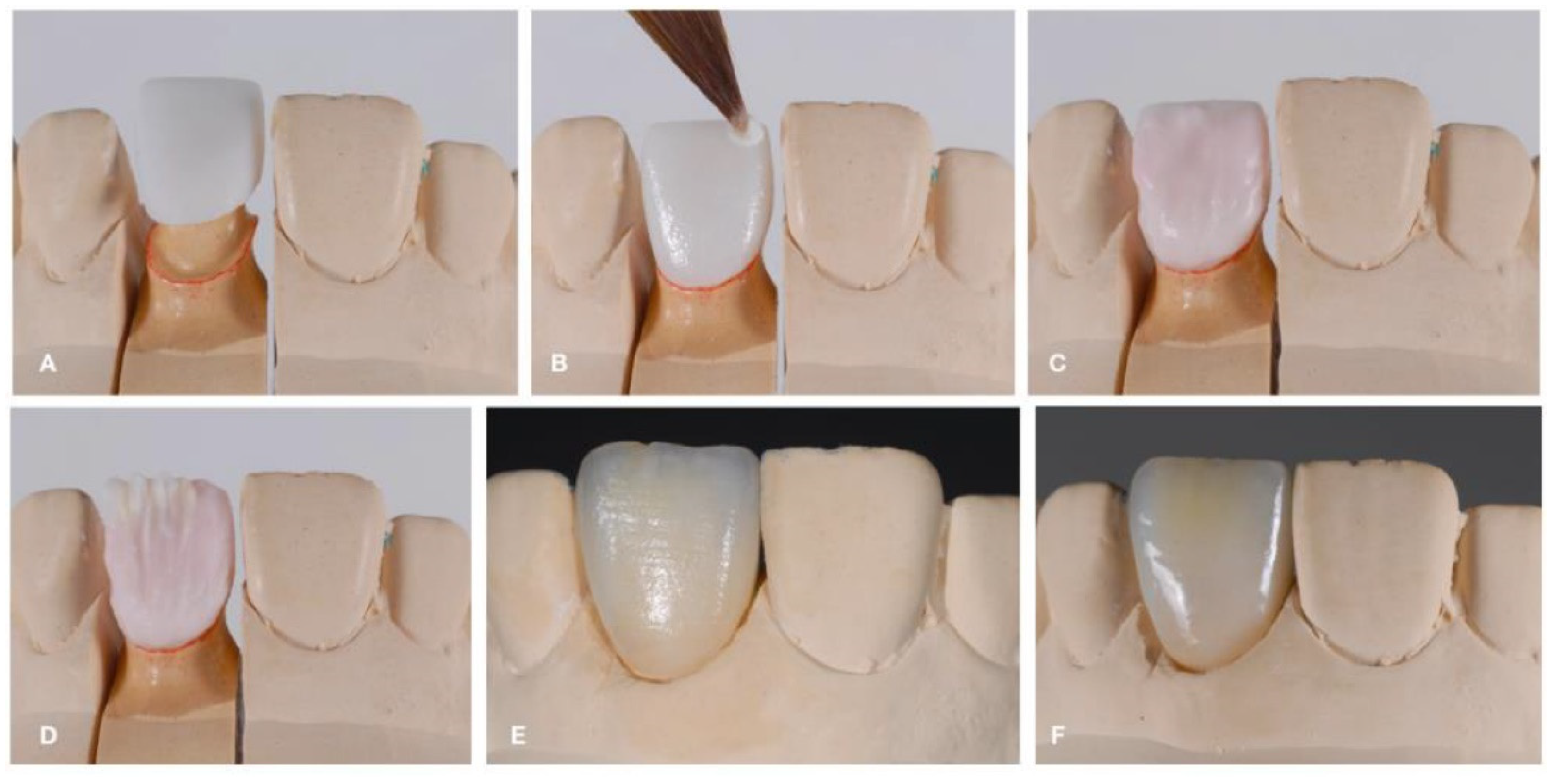 Dentistry 12 00047 g007 Dentistry 12 00047 g007