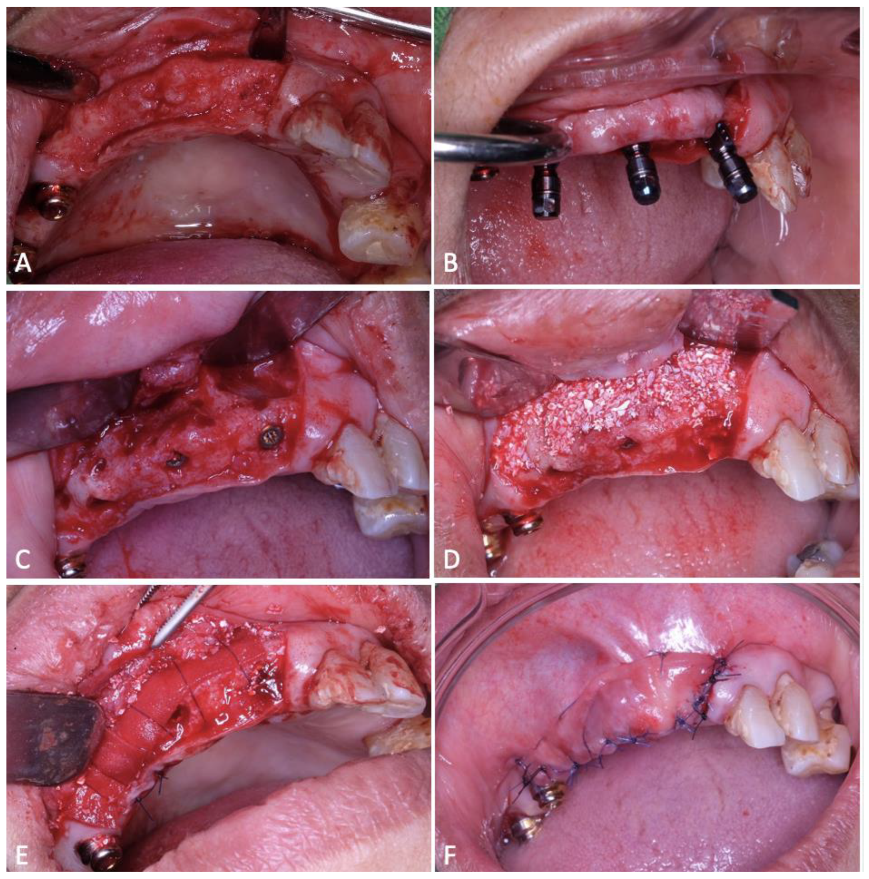 Dentistry 12 00052 g002 Dentistry 12 00052 g002