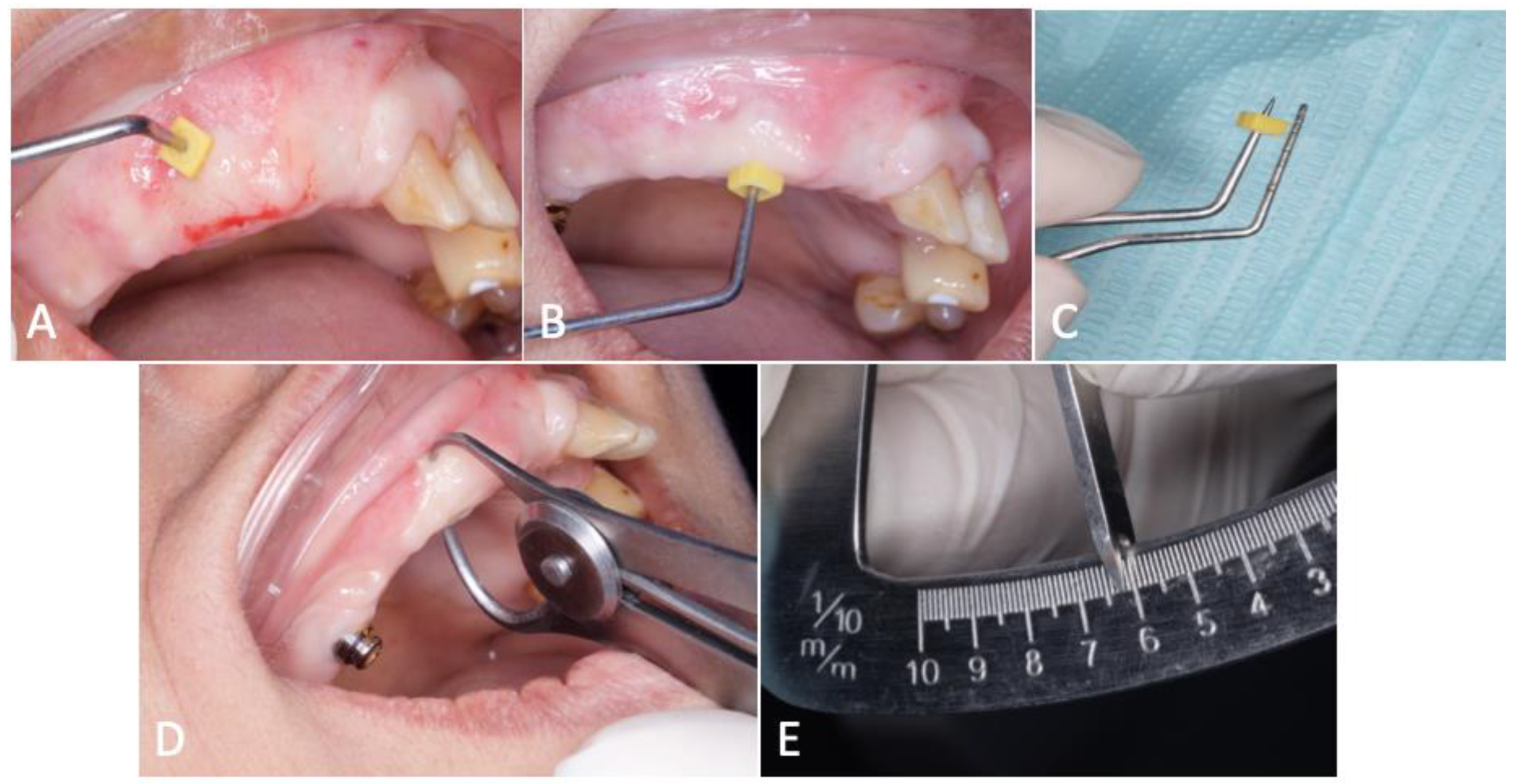 Dentistry 12 00052 g004 Dentistry 12 00052 g004