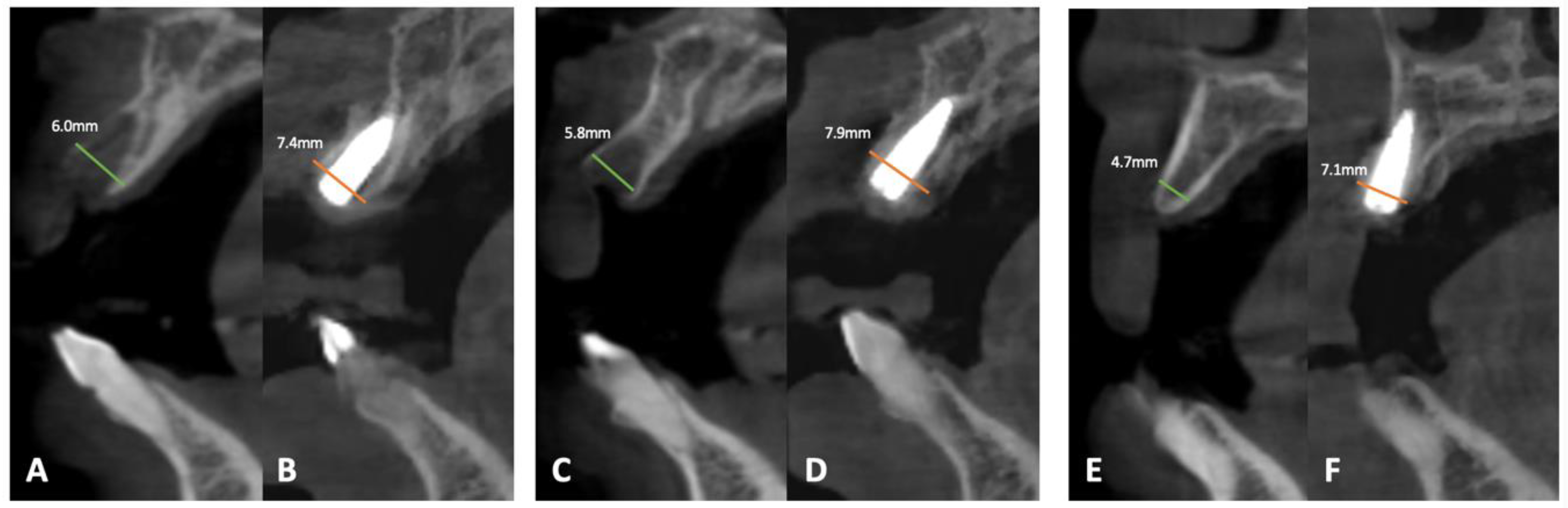 Dentistry 12 00052 g005 Dentistry 12 00052 g005