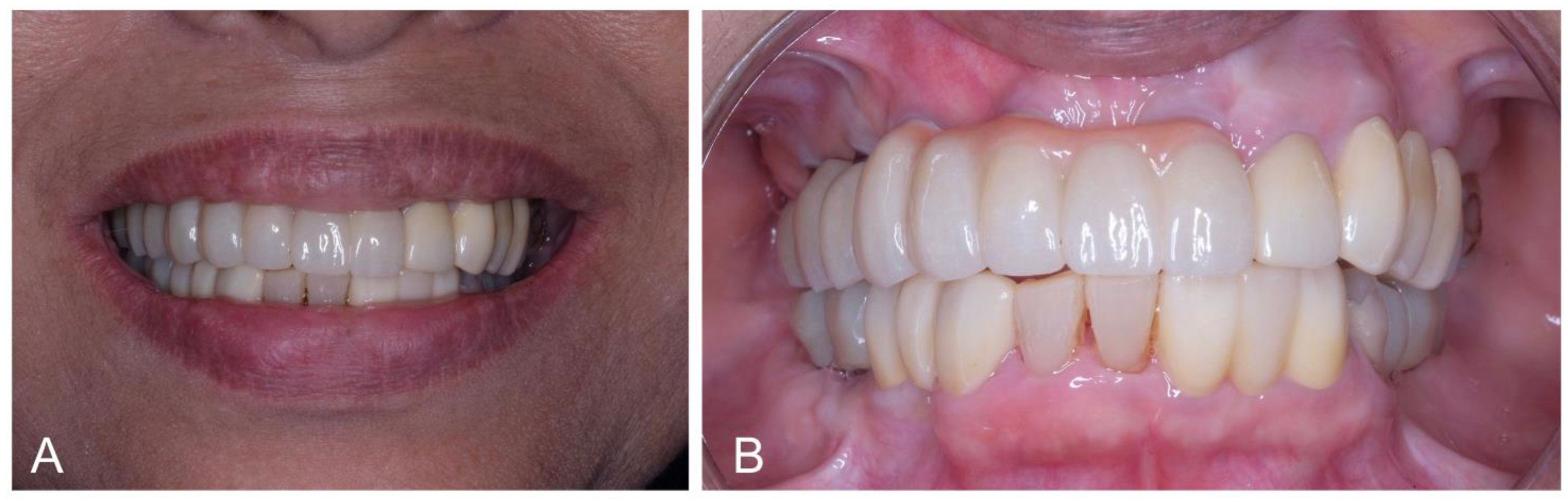 Dentistry 12 00052 g006 Dentistry 12 00052 g006