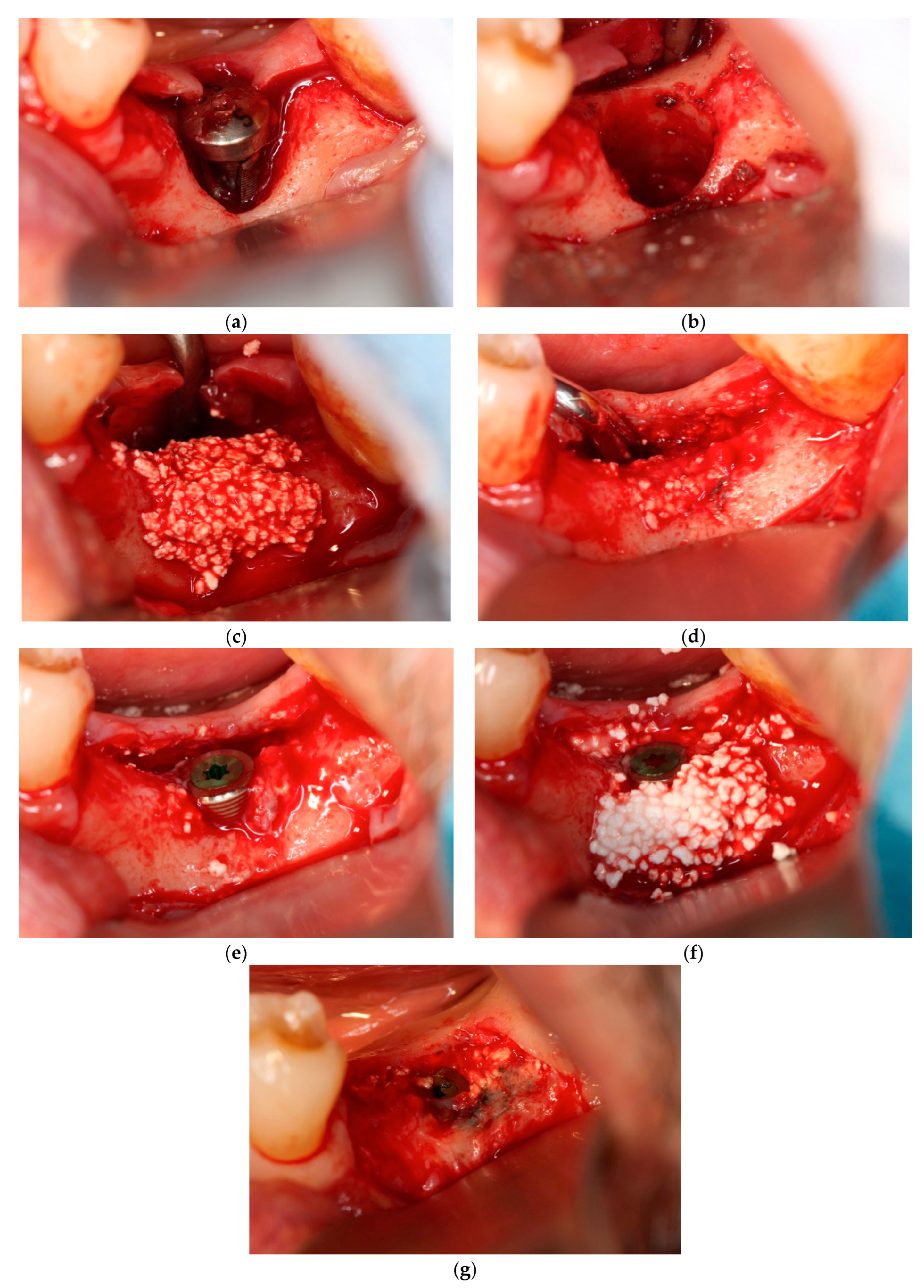 Dentistry 12 00055 g002
