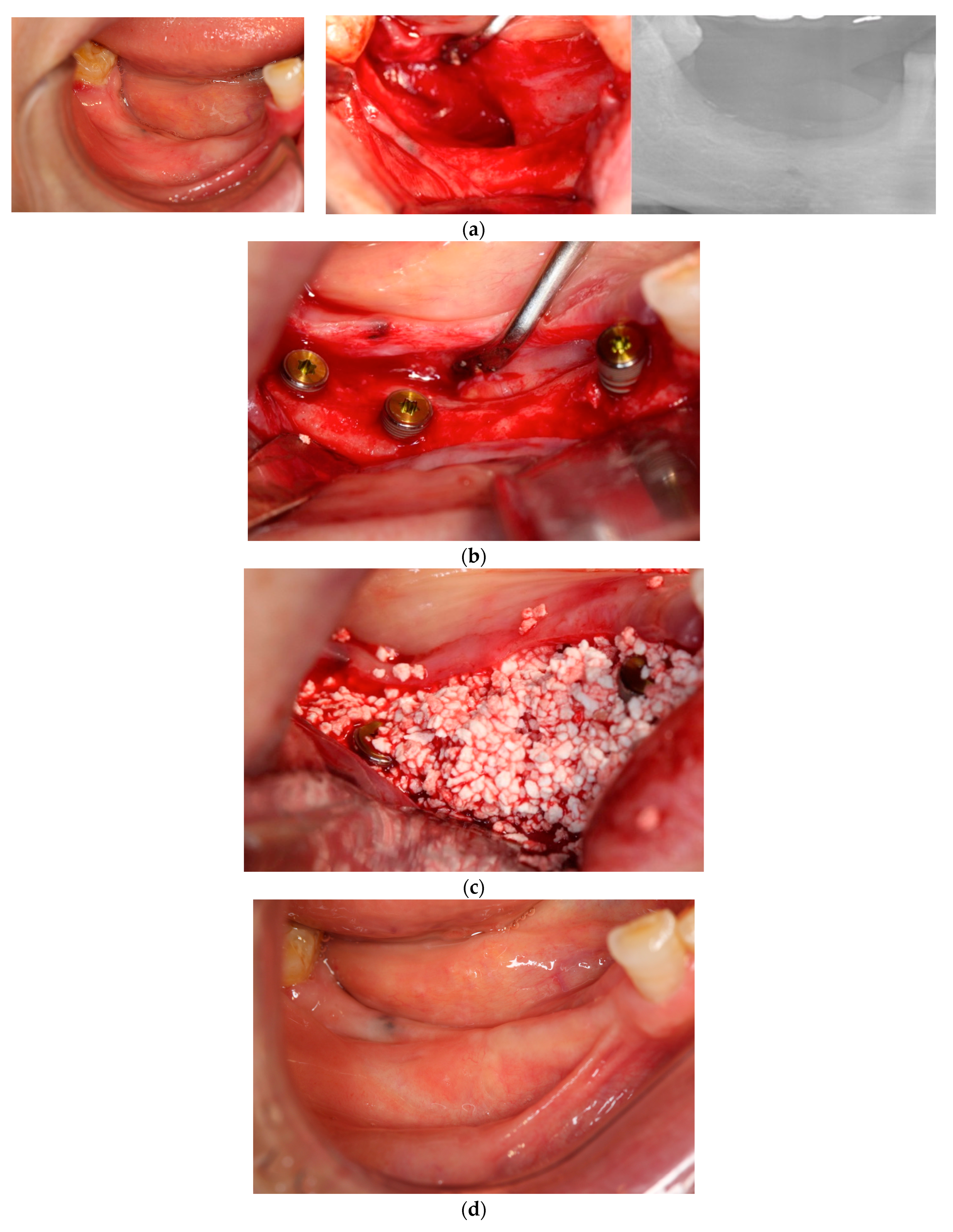 Dentistry 12 00055 g003a