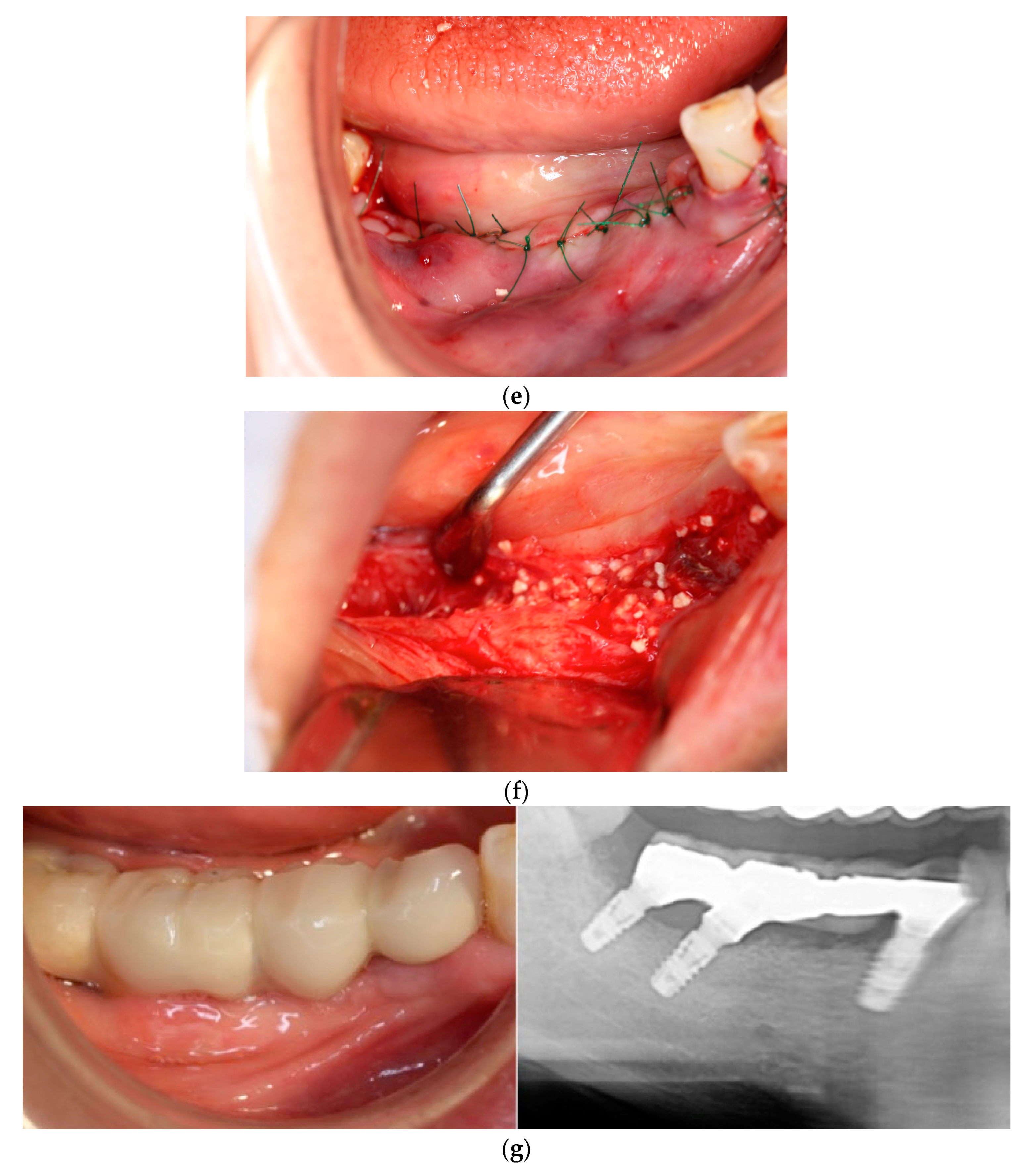 Dentistry 12 00055 g003b