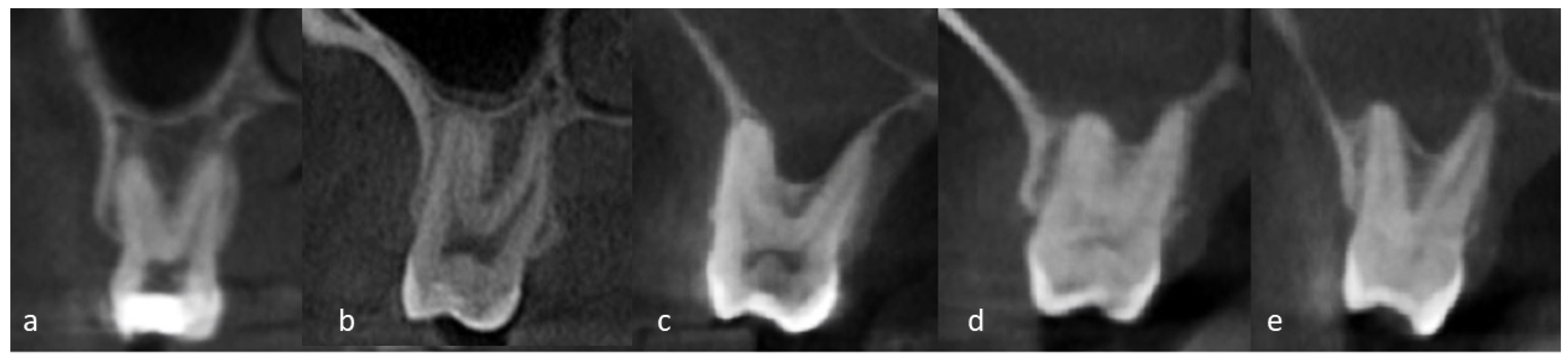 Dentistry 12 00074 g001 Dentistry 12 00074 g001