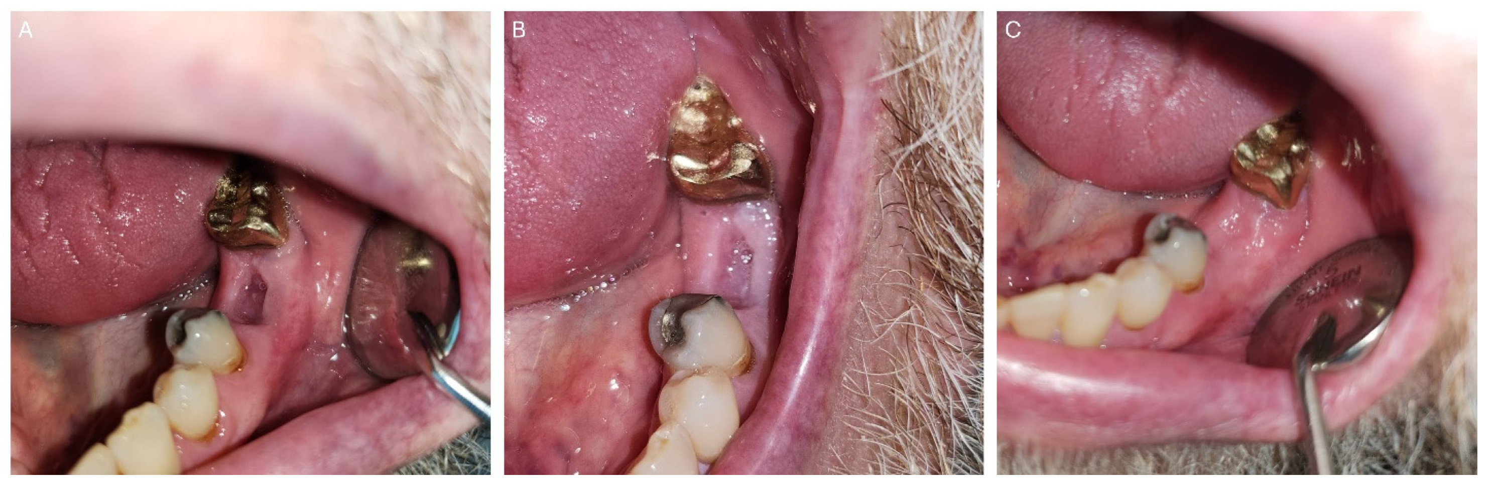 Dentistry 12 00083 g005