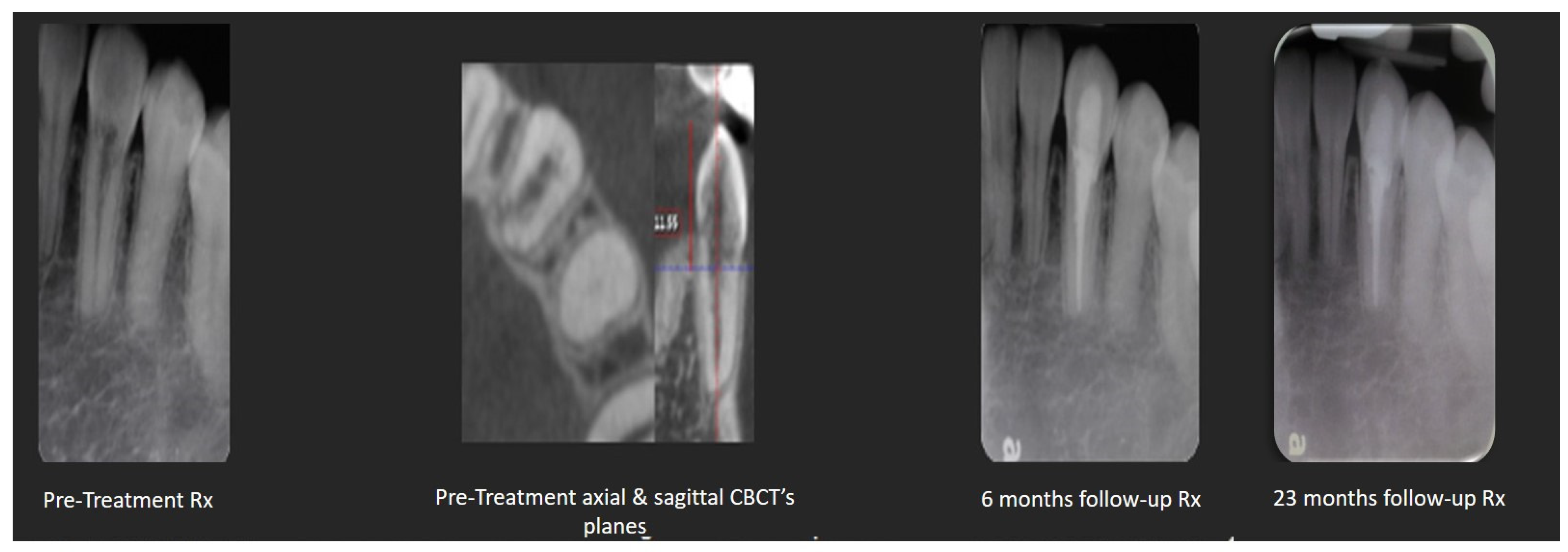 Dentistry 12 00085 g003