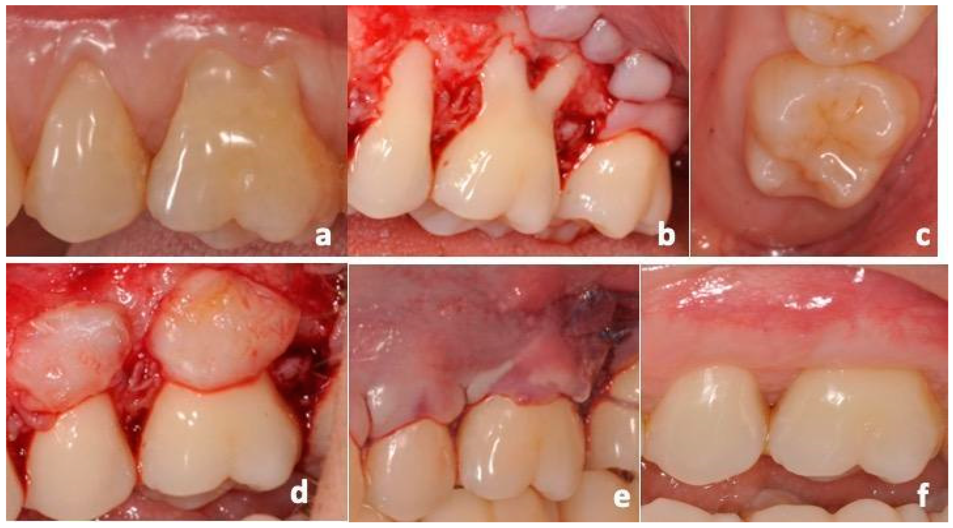 Dentistry 12 00086 g006