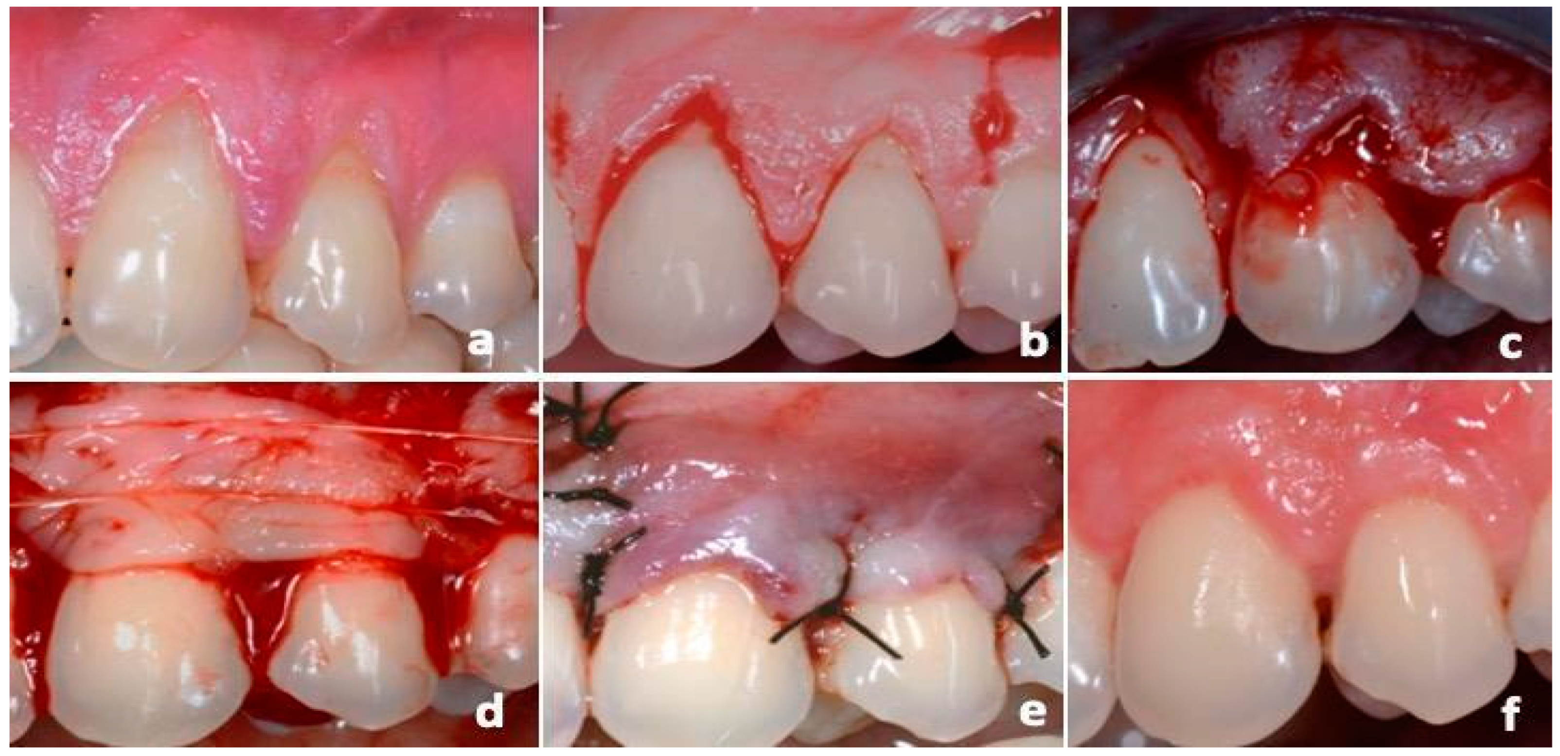 Dentistry 12 00086 g007