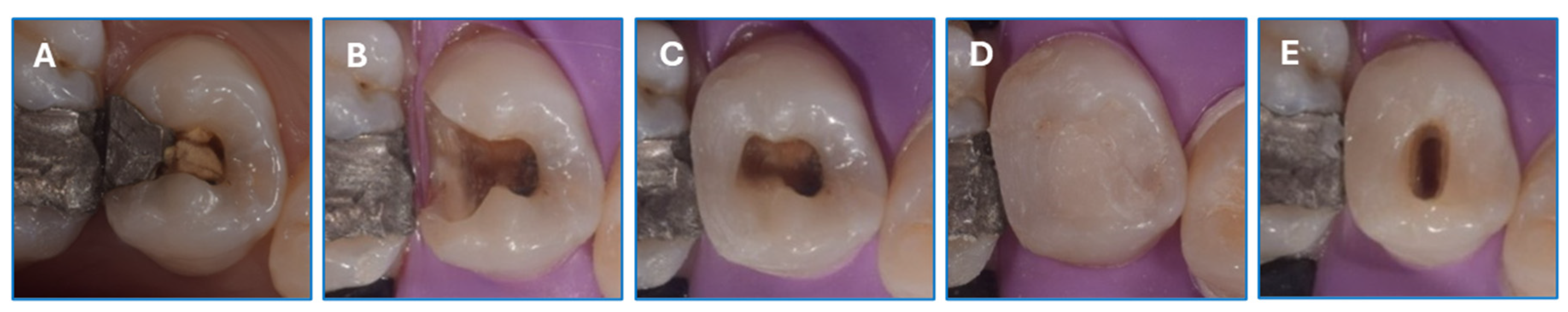 Dentistry 12 00088 g003