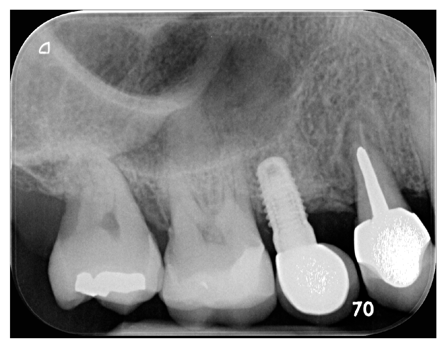 Dentistry 12 00090 g017b