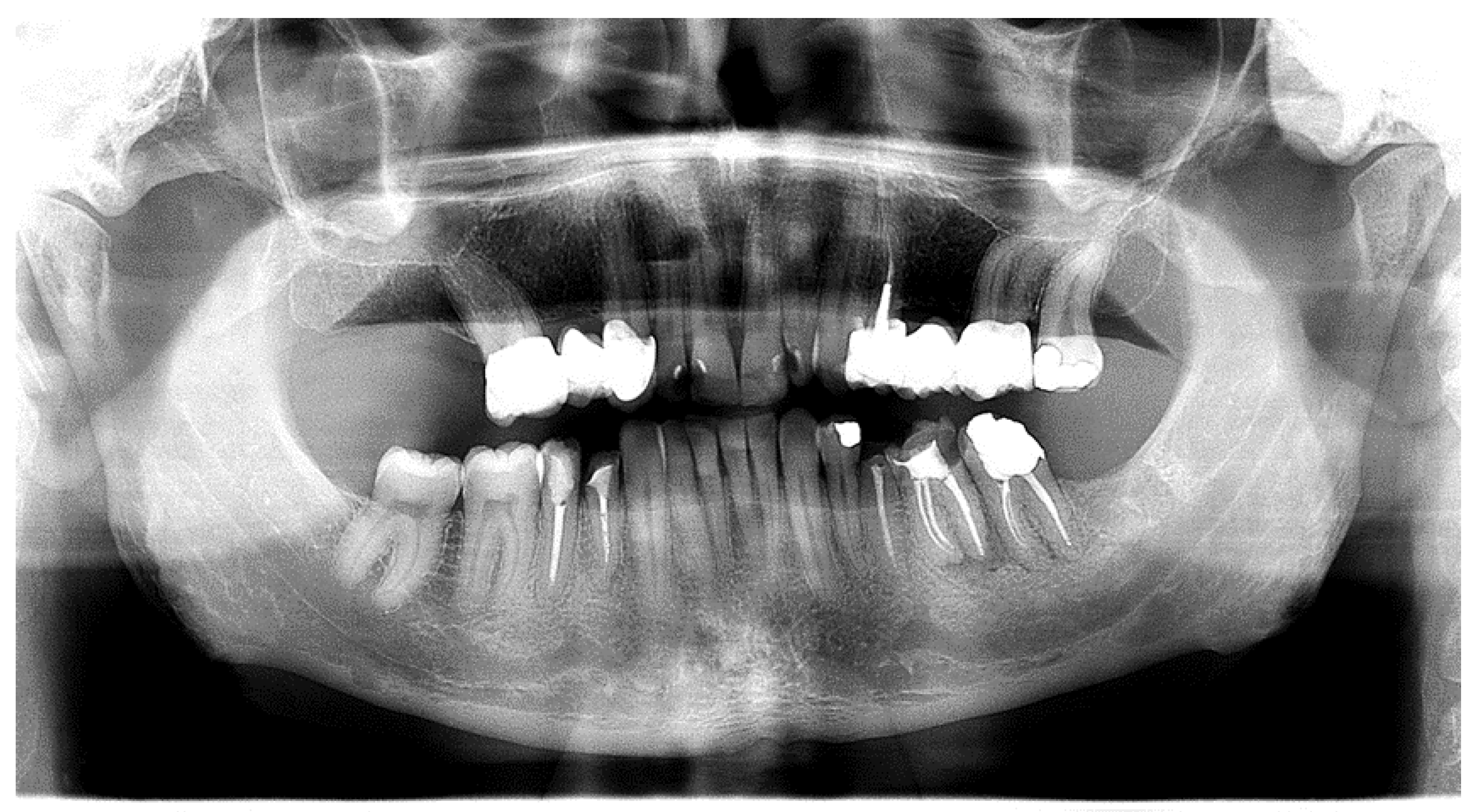 Dentistry 12 00109 g003