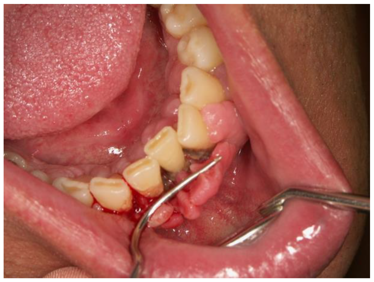 Dentistry 12 00109 g009