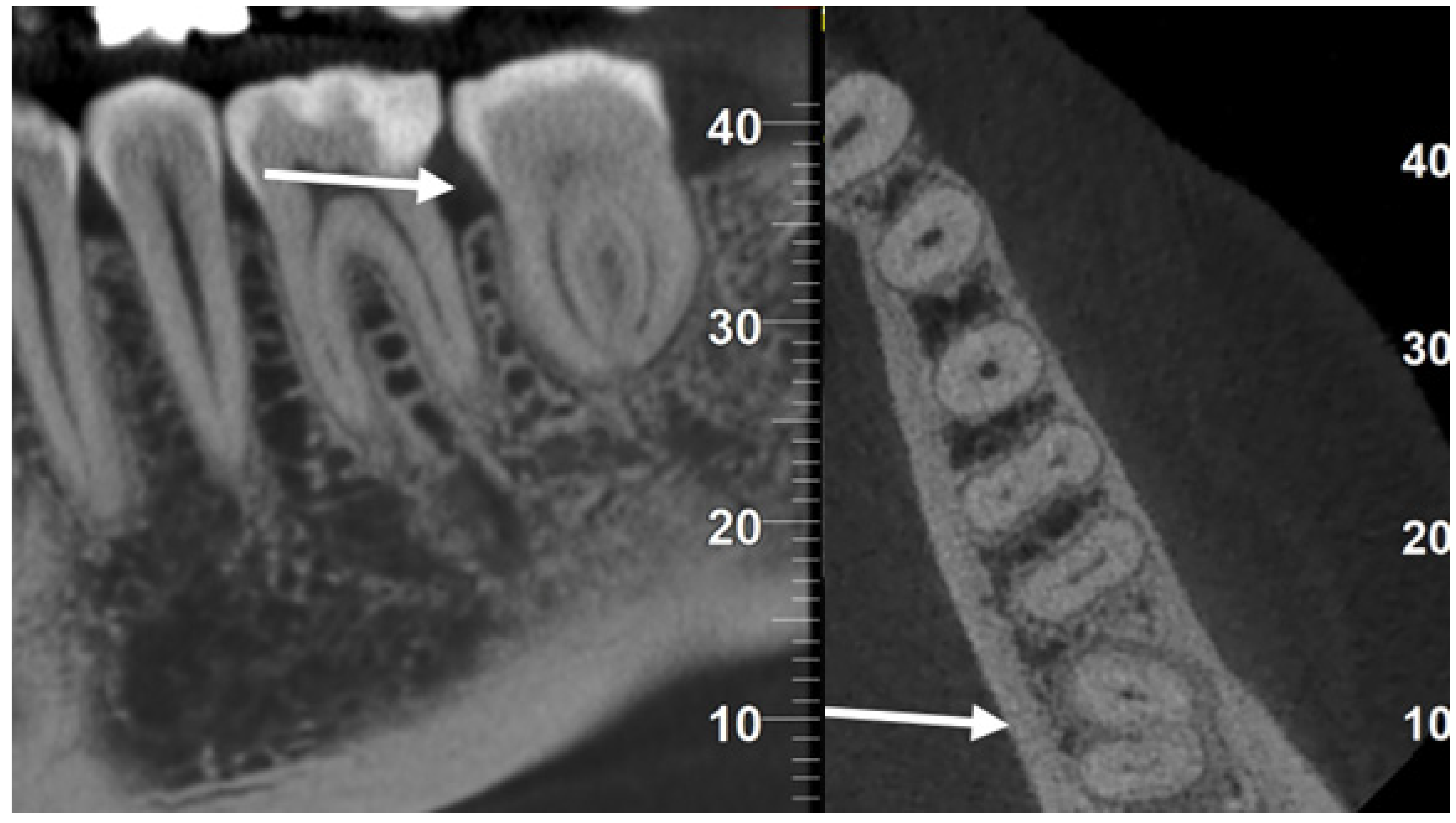 Dentistry 12 00124 g004