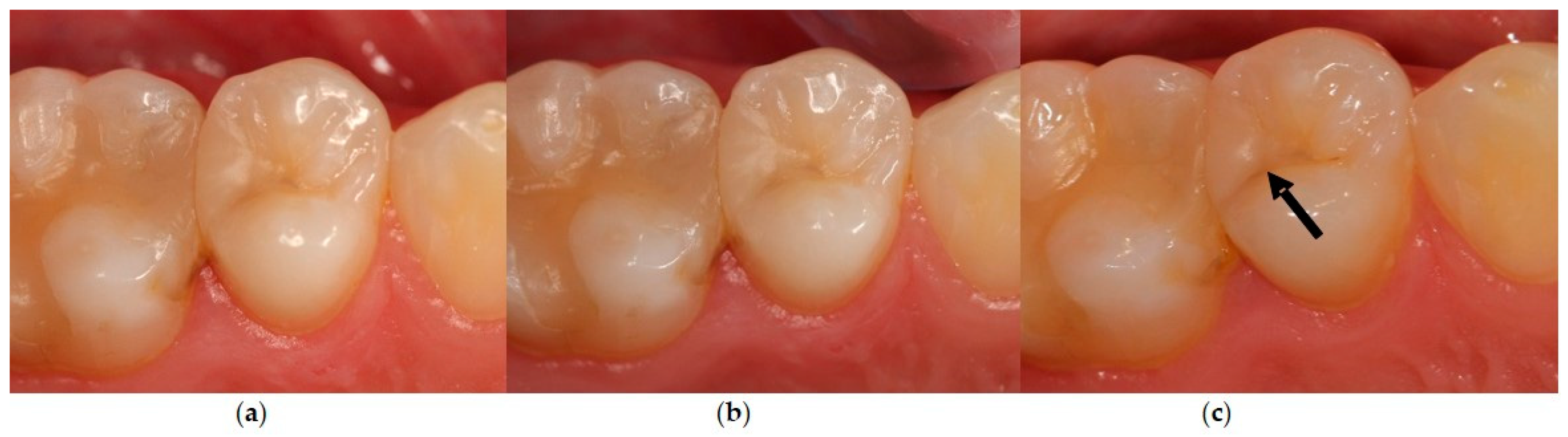 Dentistry 12 00128 g003