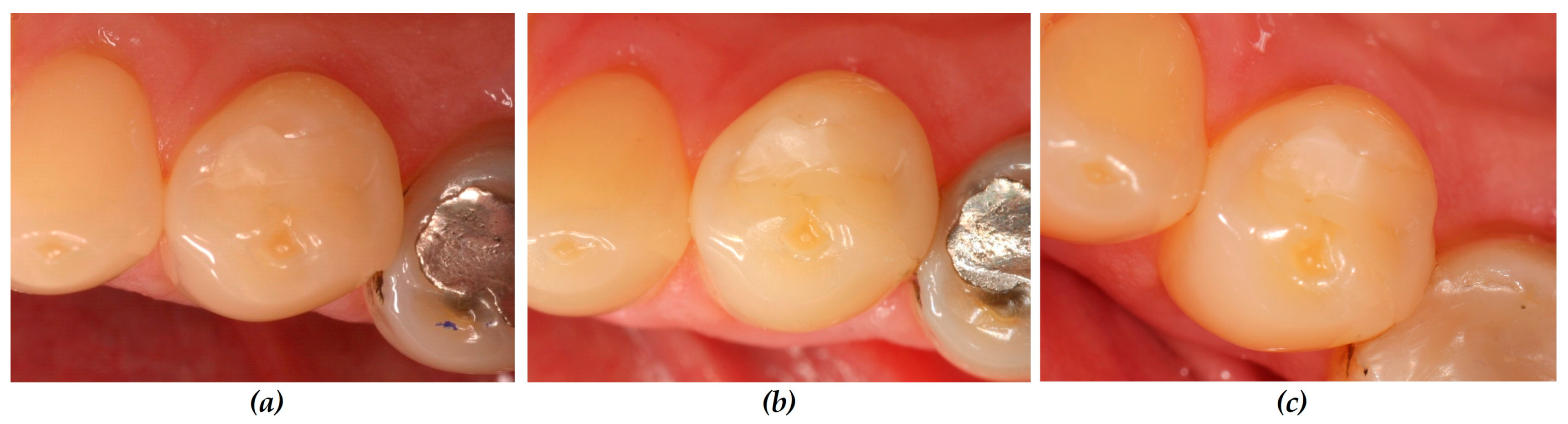 Dentistry 12 00128 g004