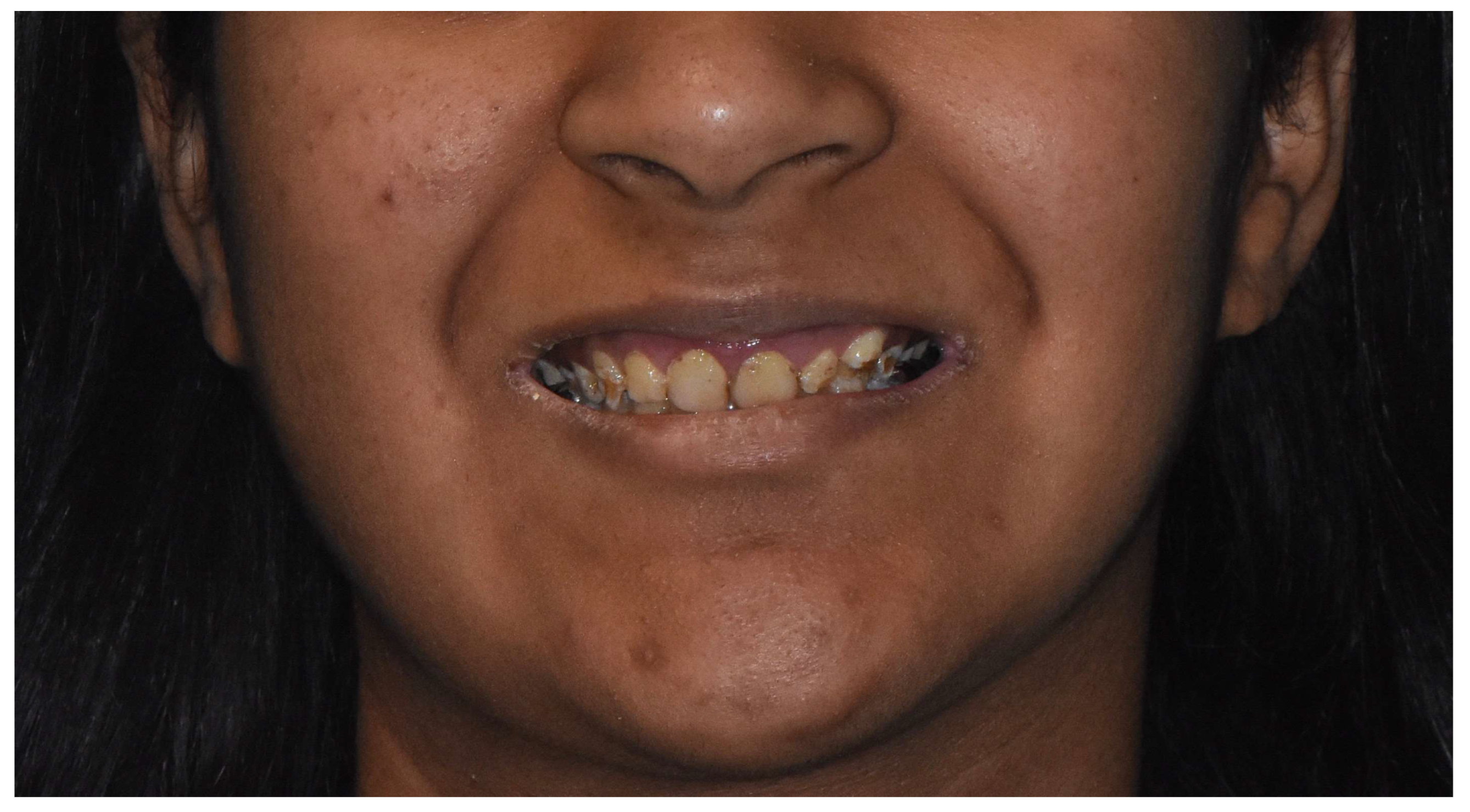 Dentistry 12 00130 g002