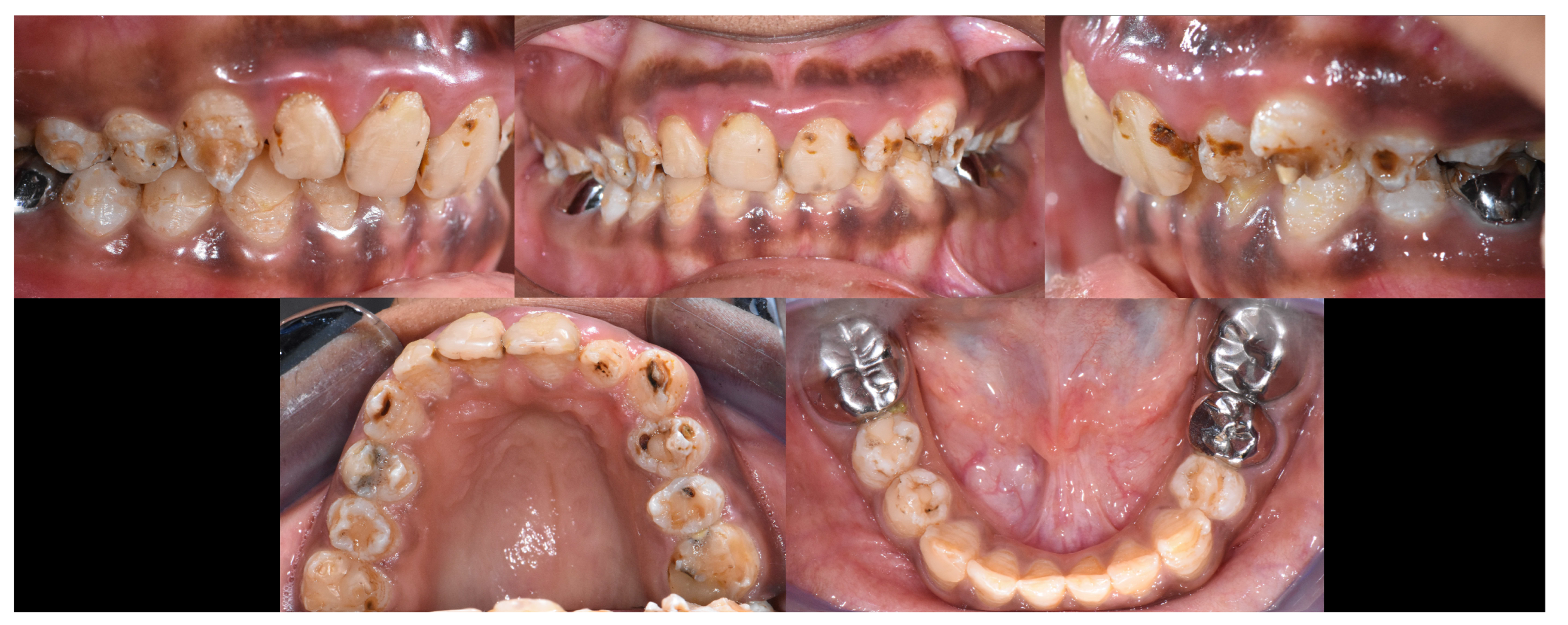 Dentistry 12 00130 g003