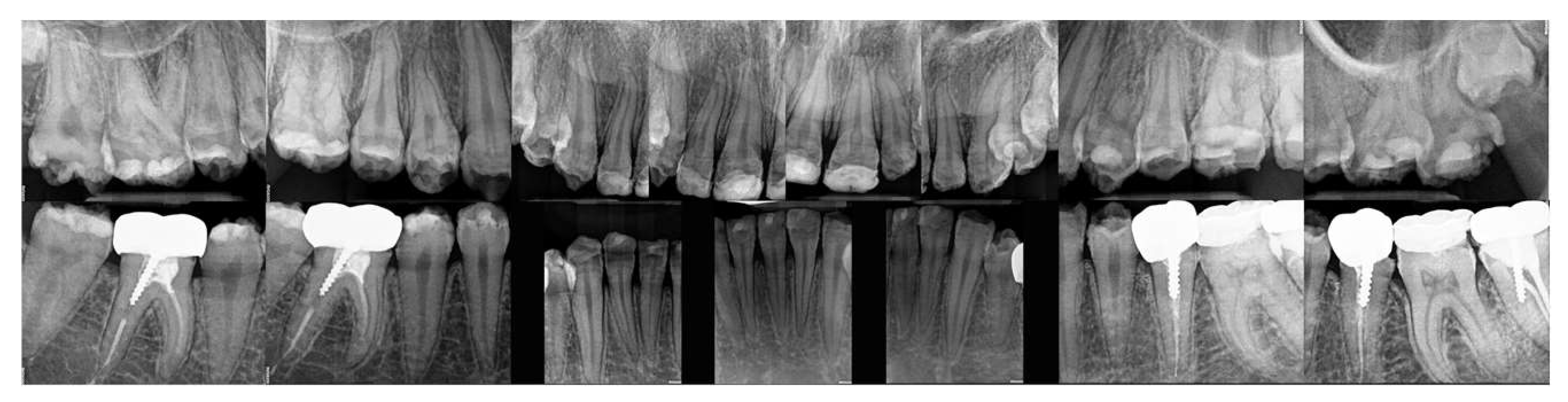 Dentistry 12 00130 g004