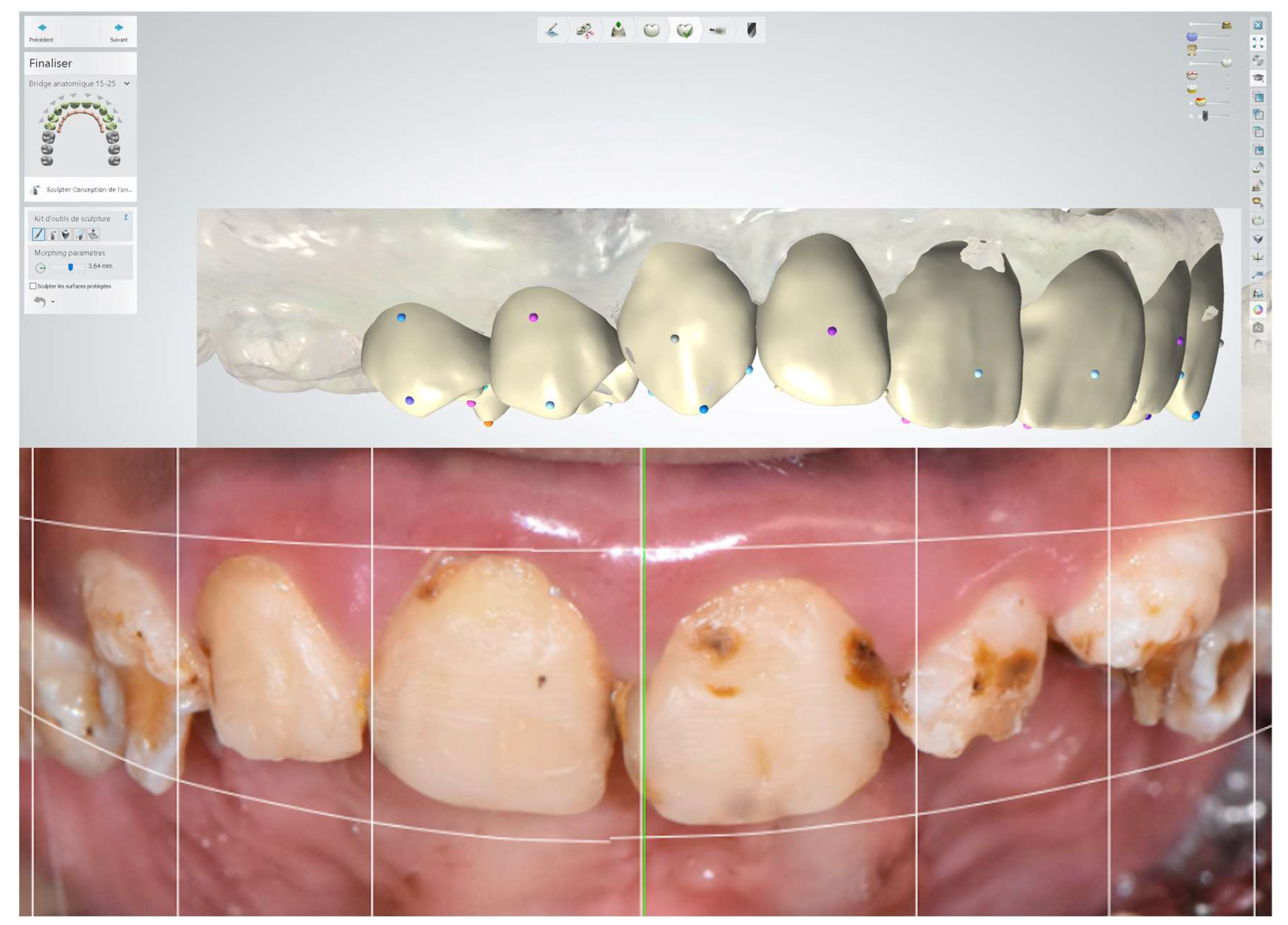 Dentistry 12 00130 g006