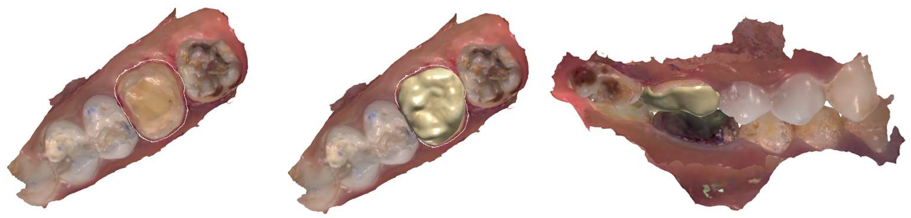 Dentistry 12 00130 g007