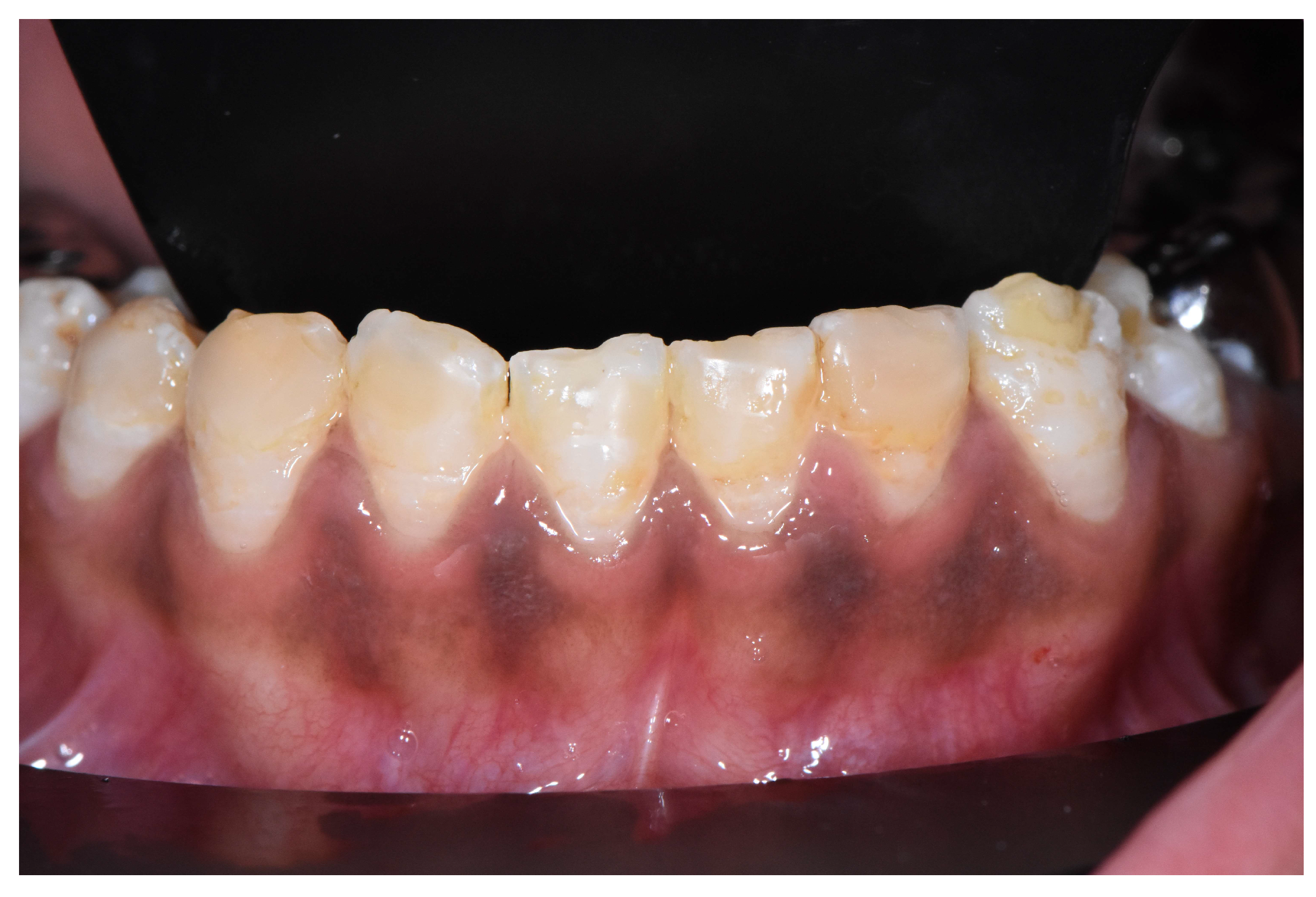 Dentistry 12 00130 g008