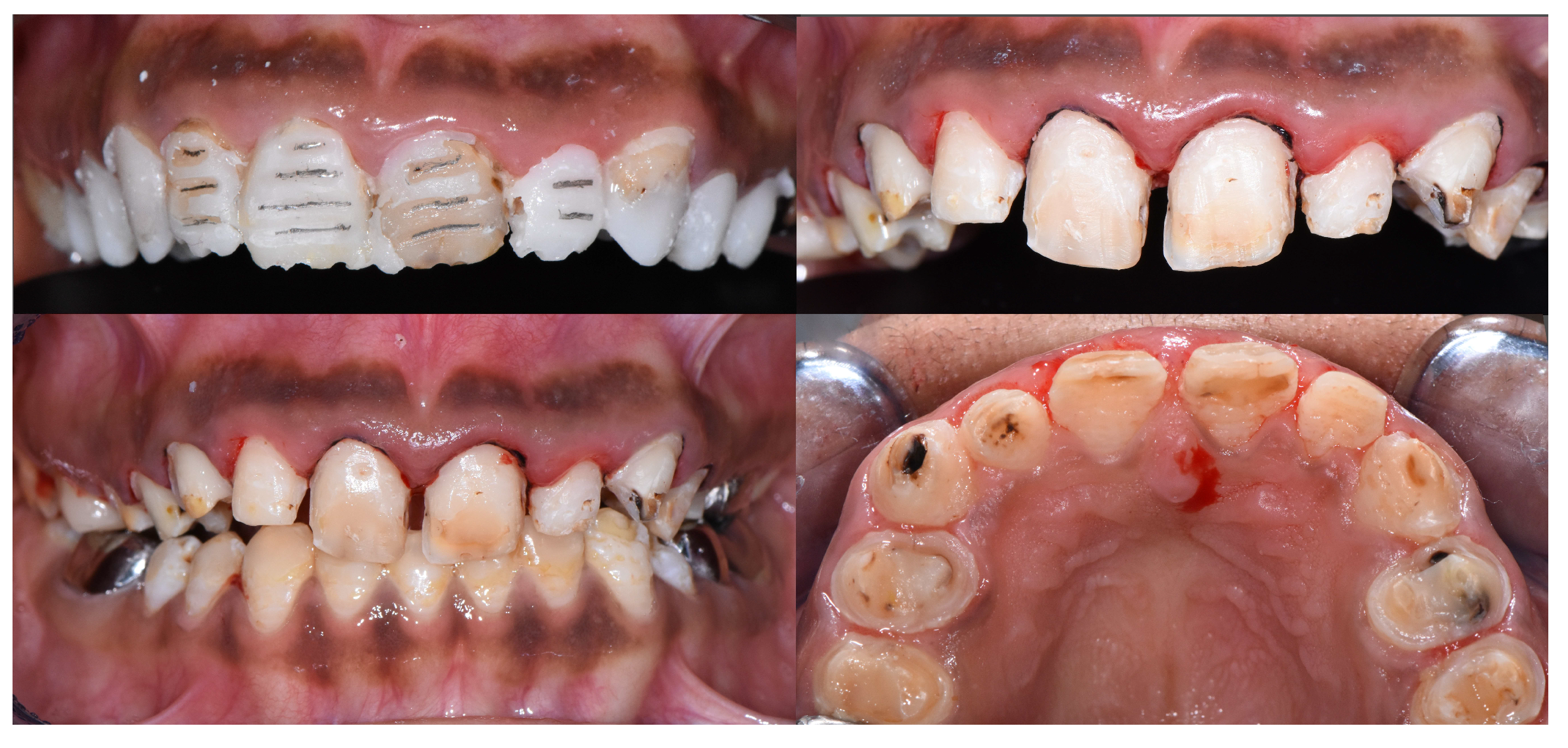 Dentistry 12 00130 g009