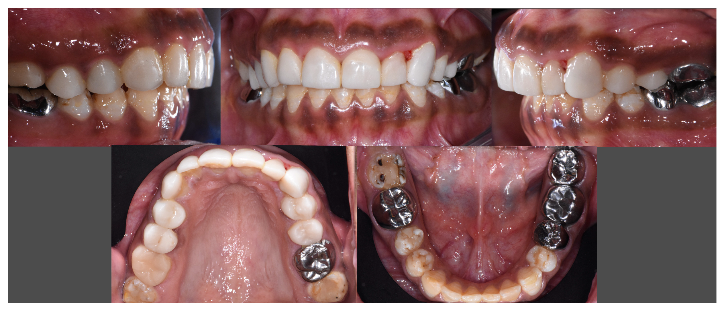 Dentistry 12 00130 g010