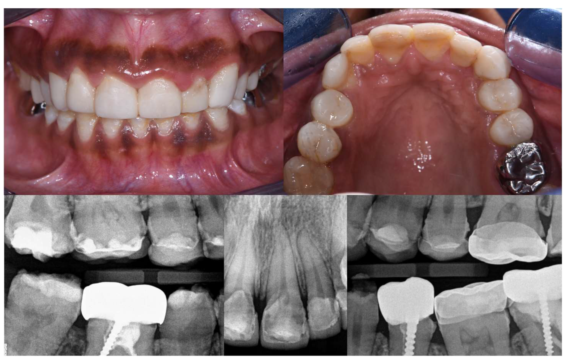 Dentistry 12 00130 g011