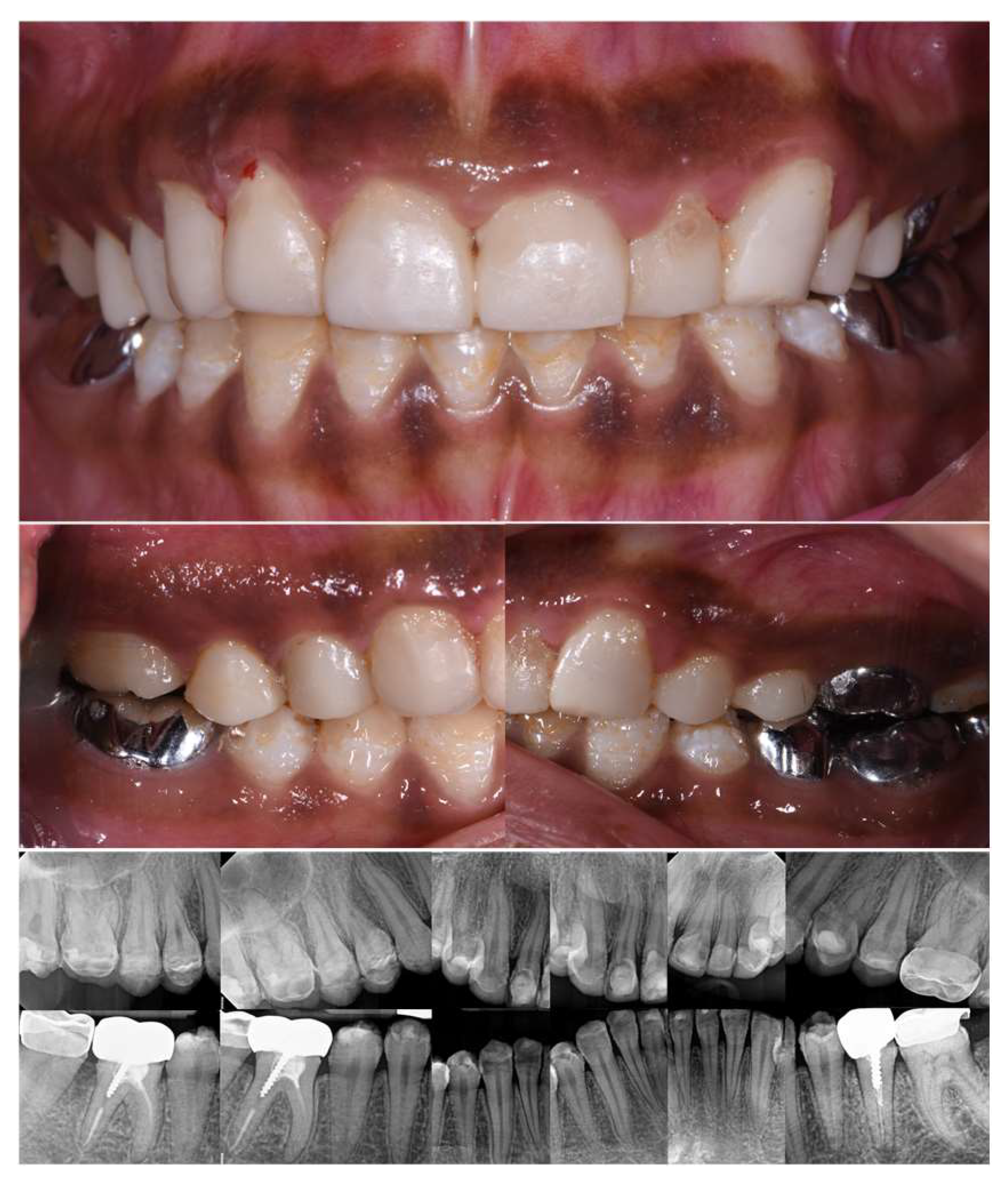 Dentistry 12 00130 g013