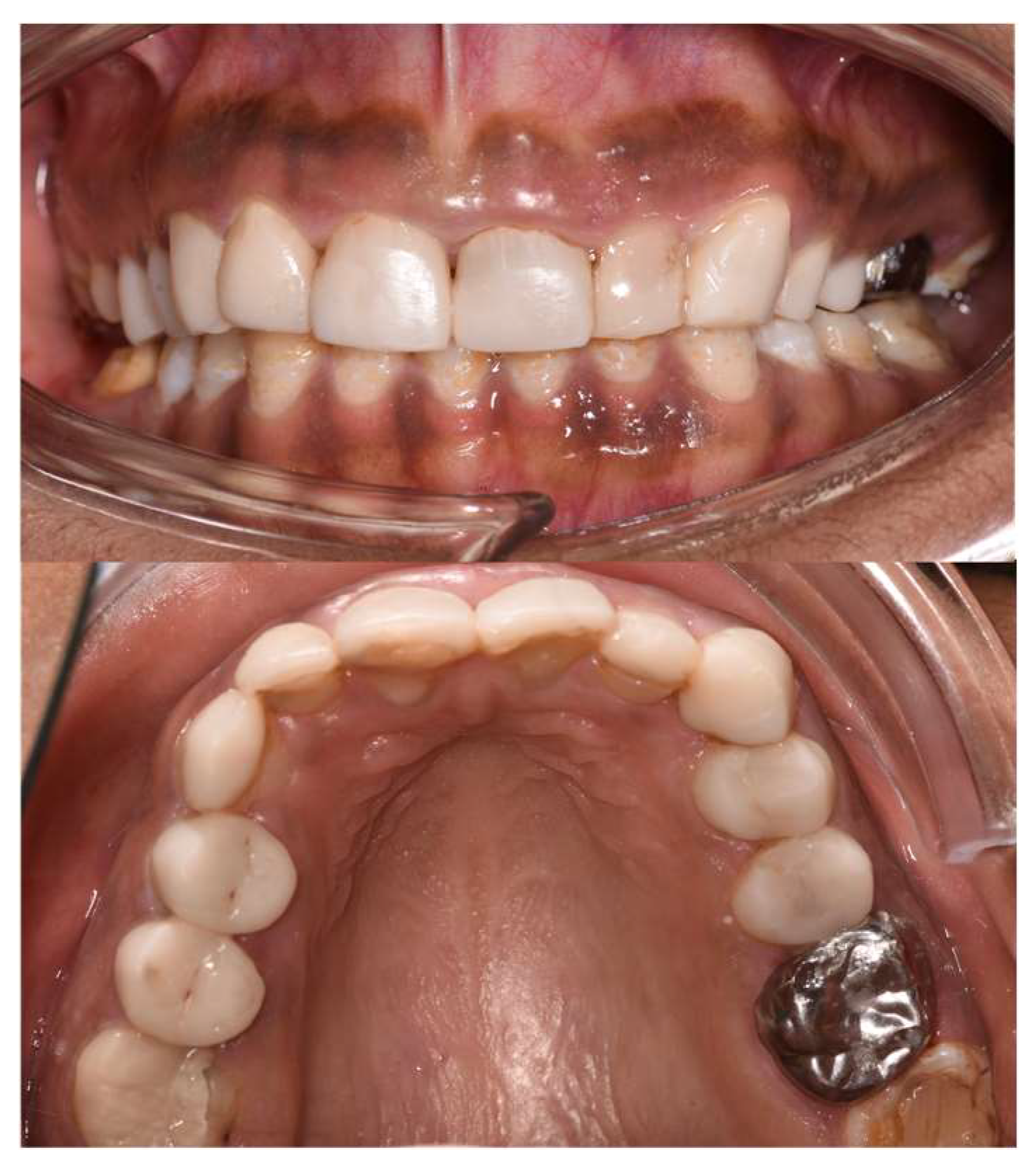 Dentistry 12 00130 g014