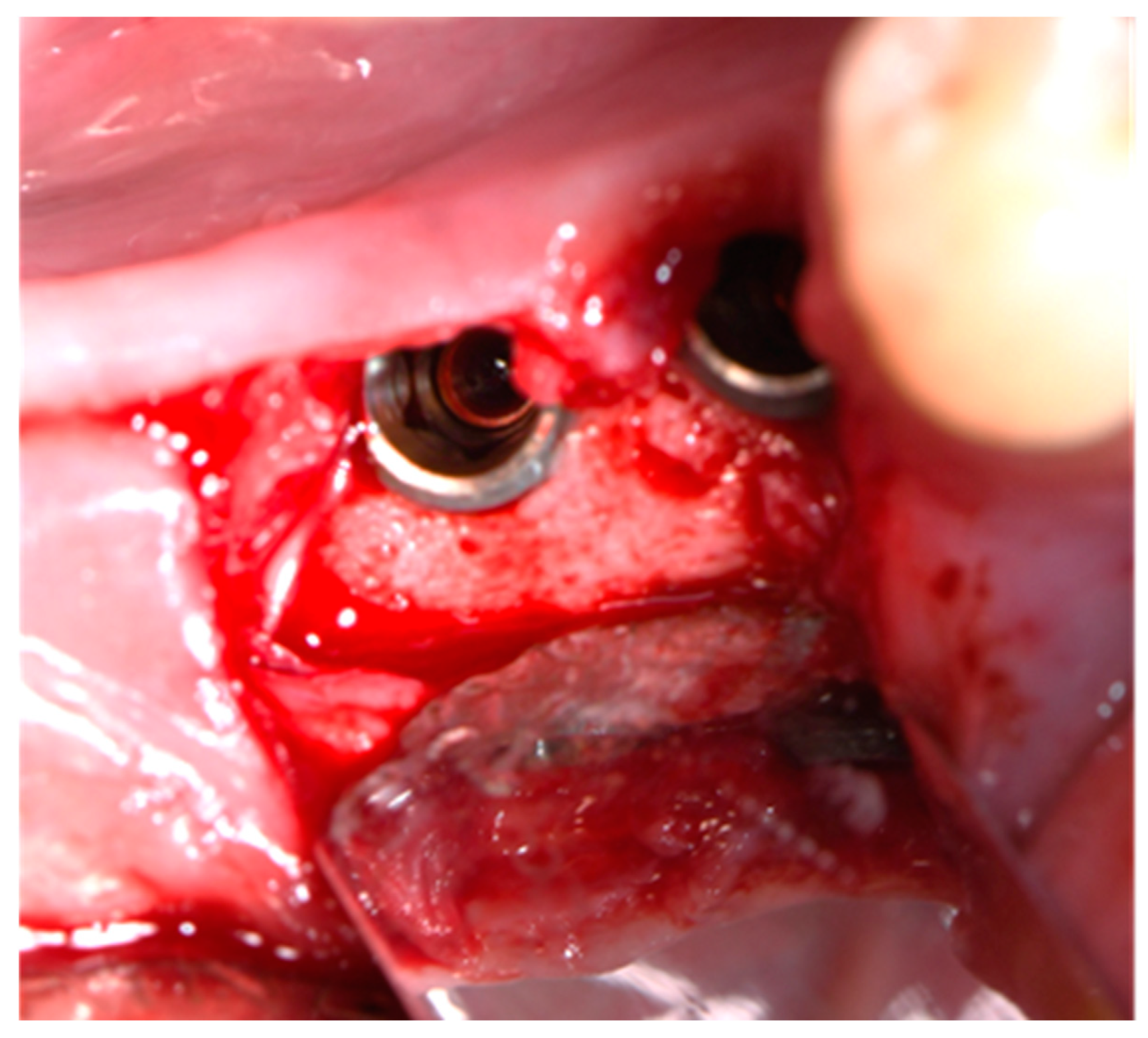 Dentistry 12 00137 g007