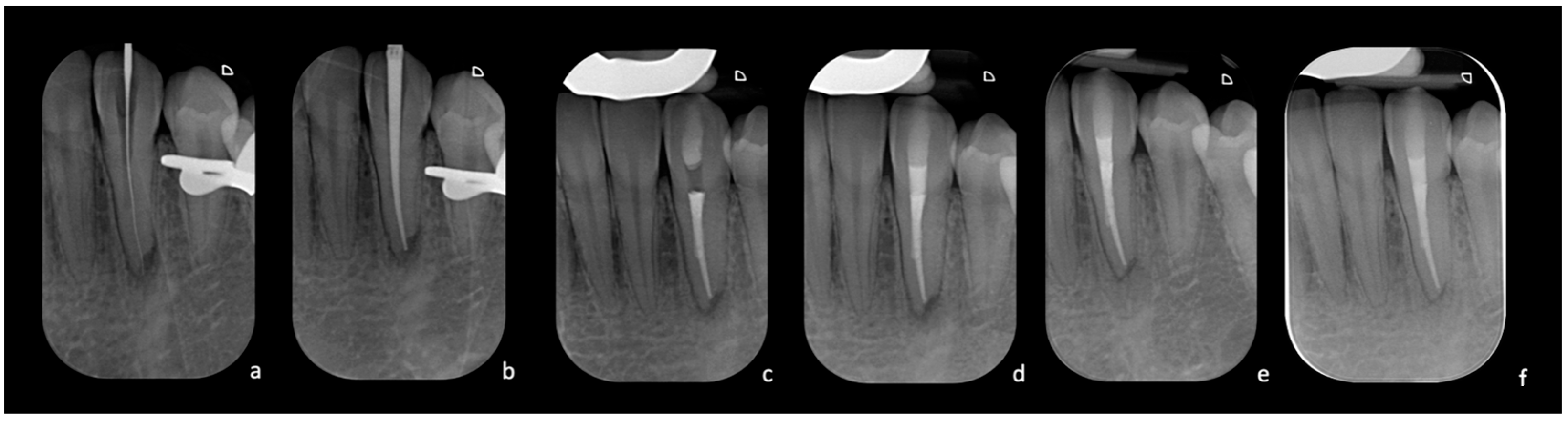 Dentistry 12 00166 g004