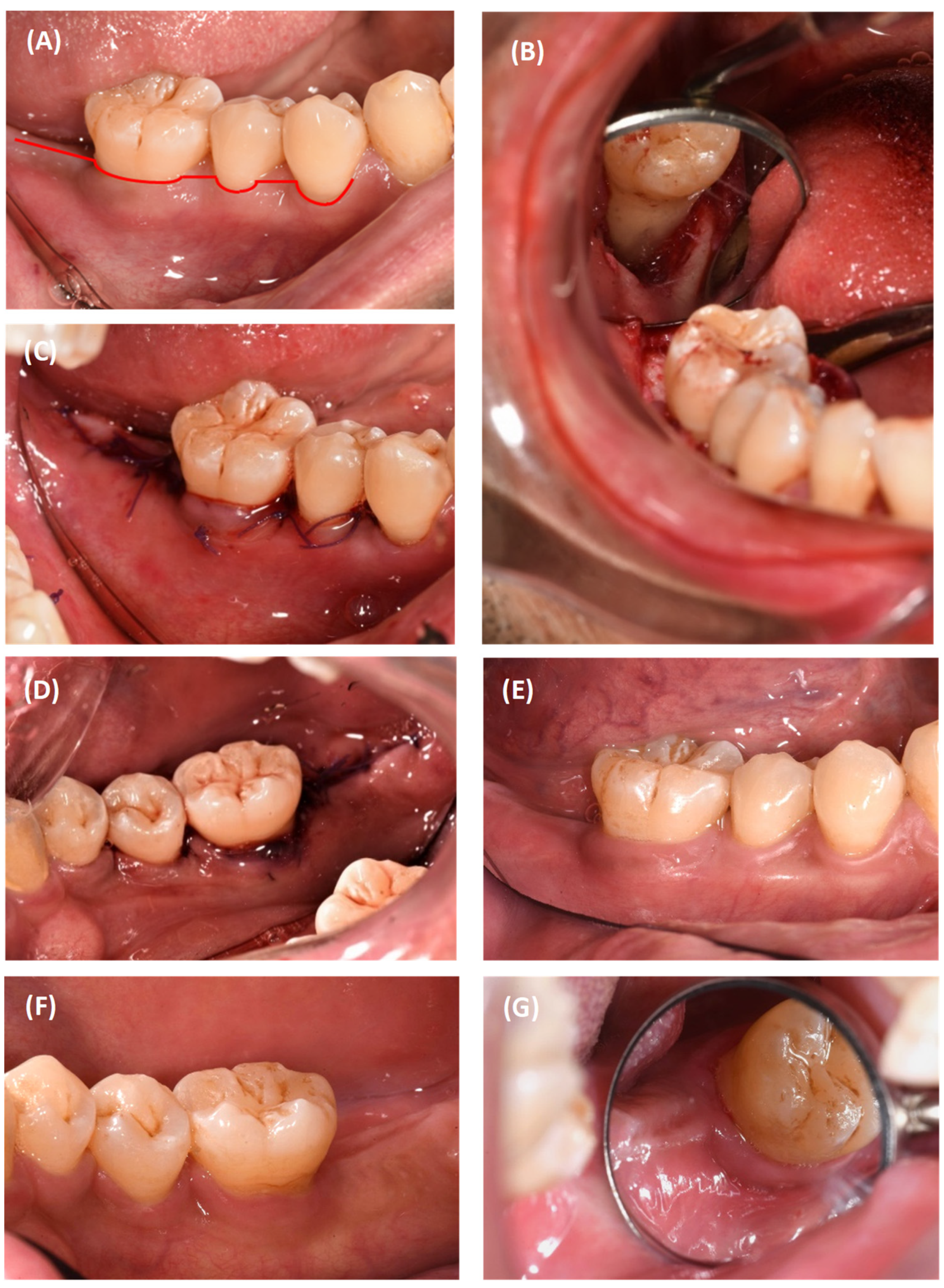 Dentistry 12 00170 g003