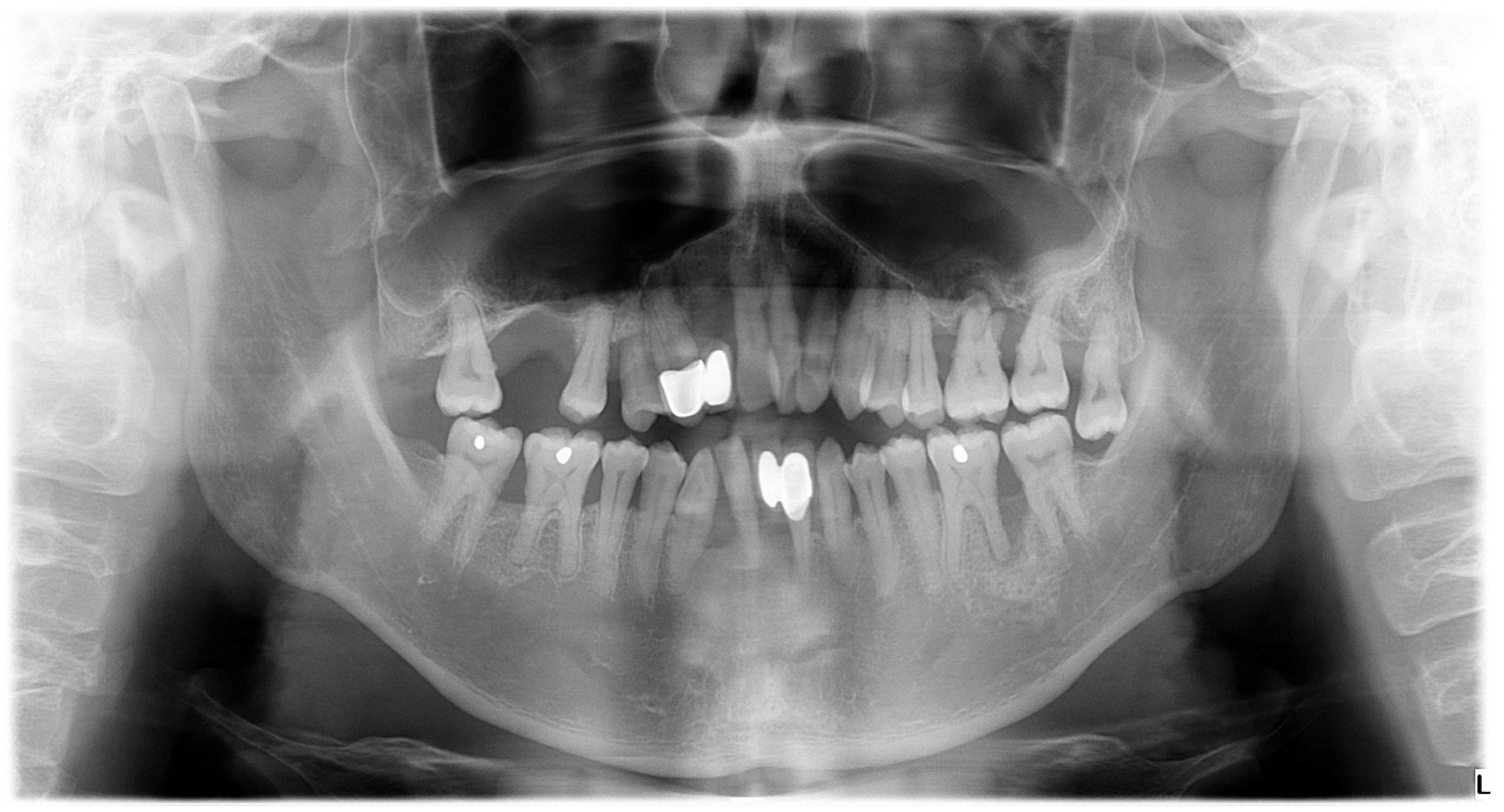 Dentistry 12 00170 g005