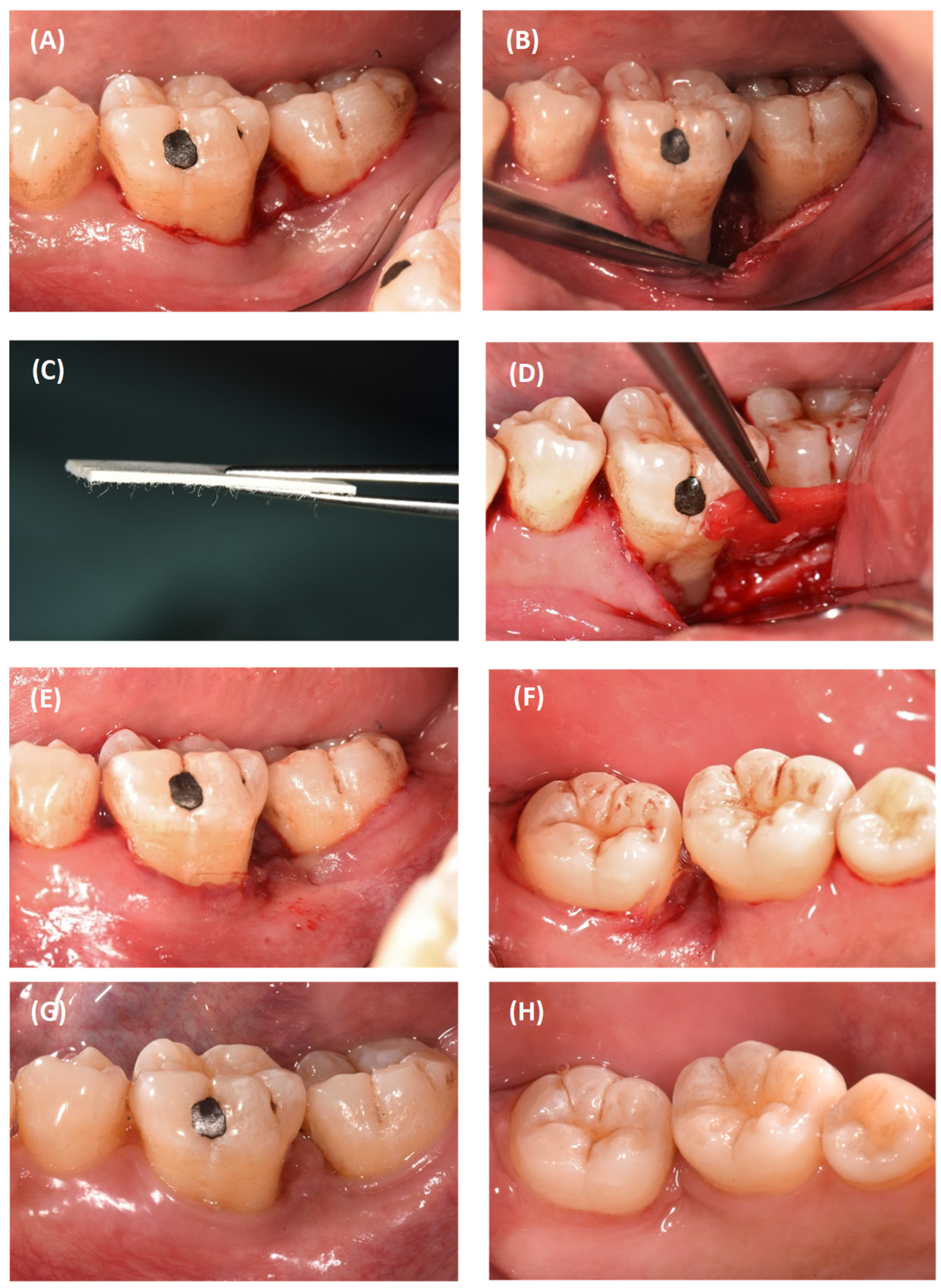 Dentistry 12 00170 g006