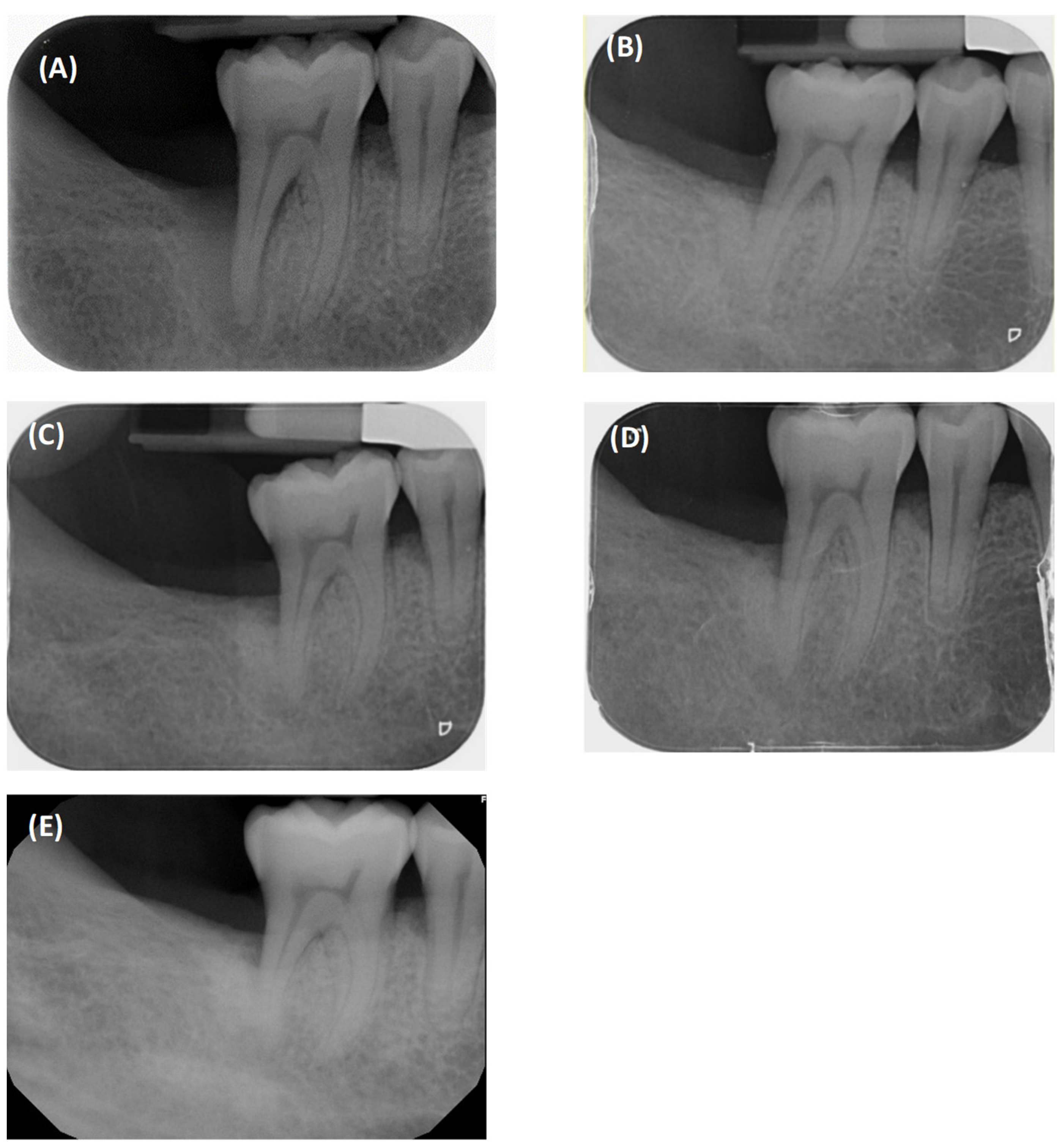 Dentistry 12 00170 g007
