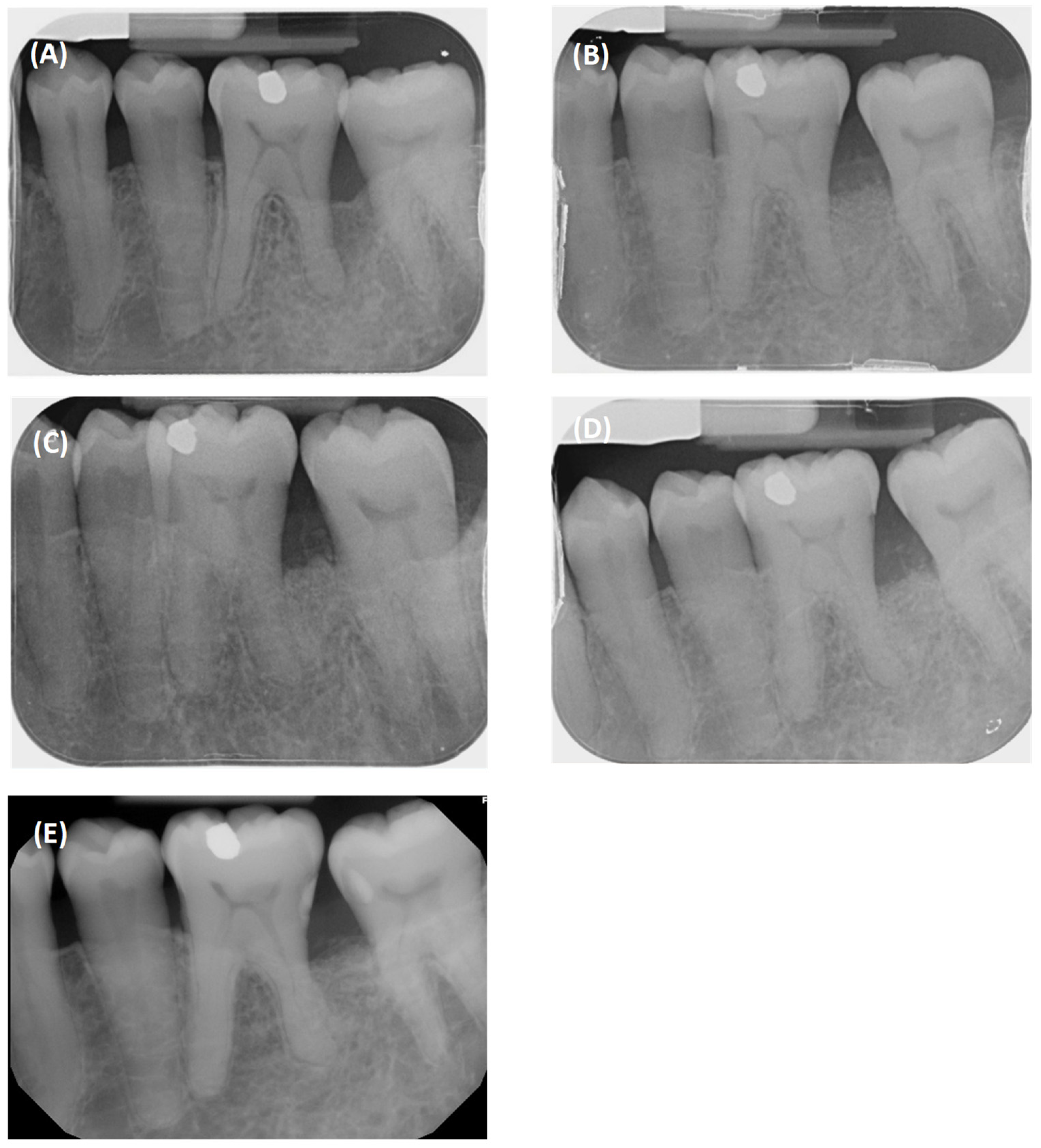 Dentistry 12 00170 g008