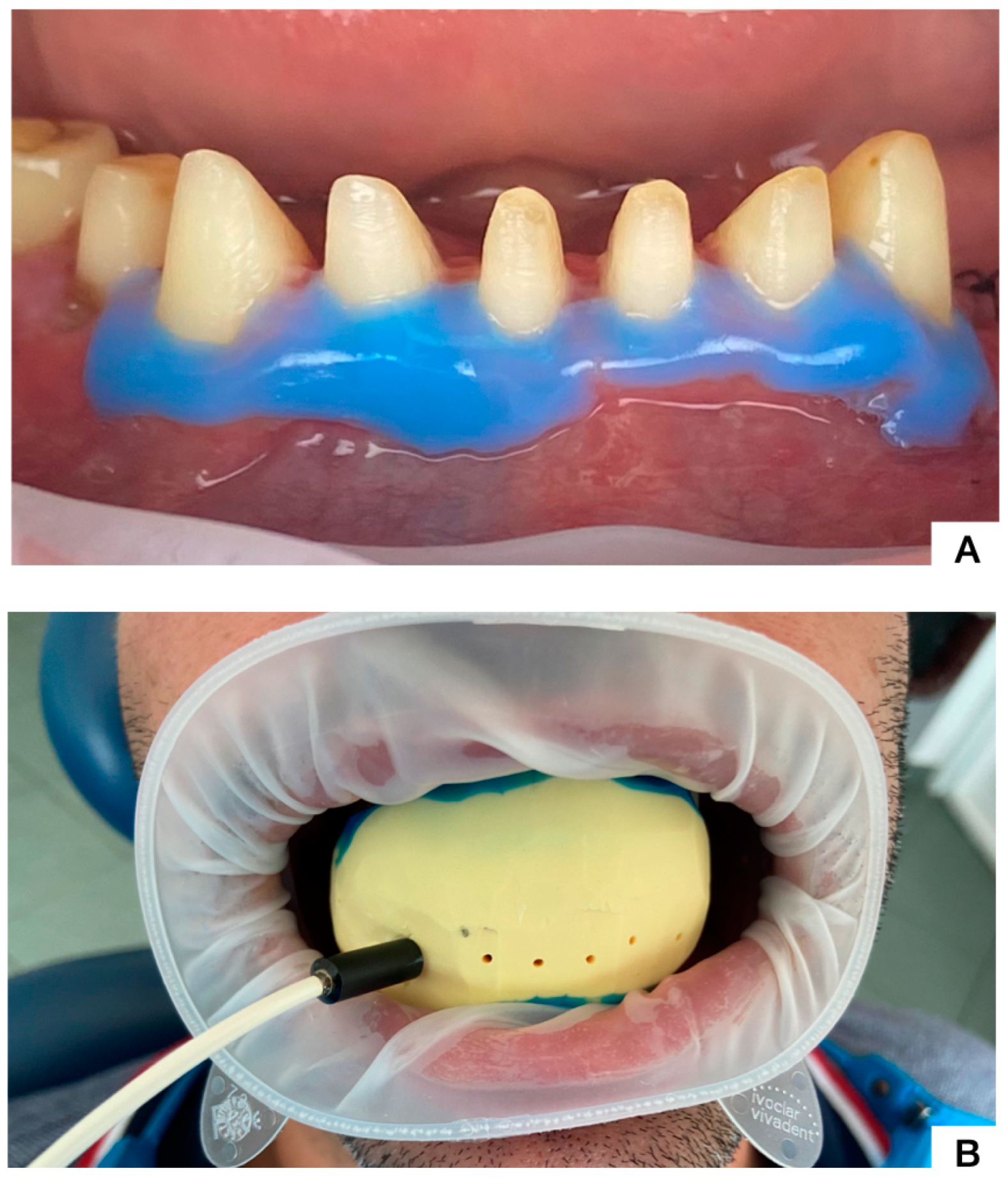 Dentistry 12 00178 g003