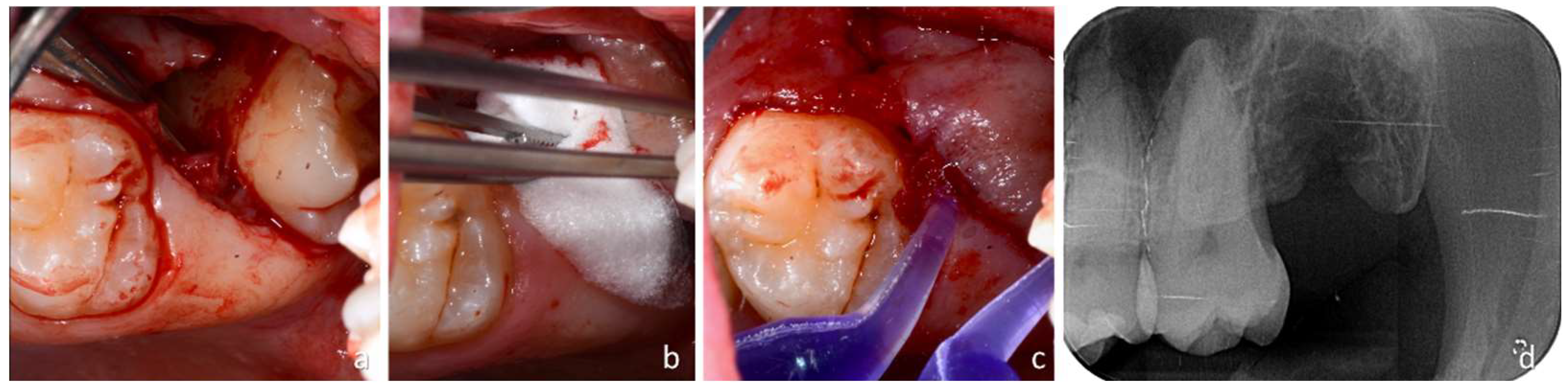 Dentistry 12 00184 g004