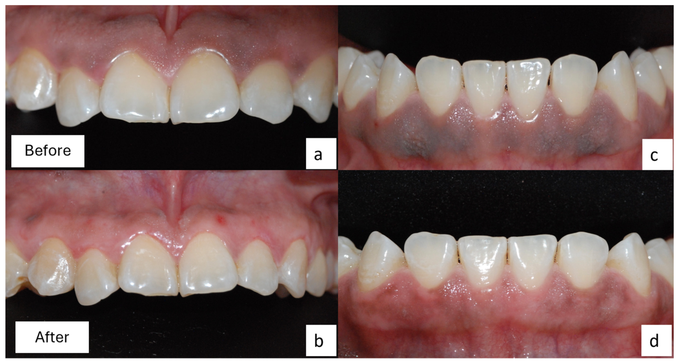 Dentistry 12 00203 g004