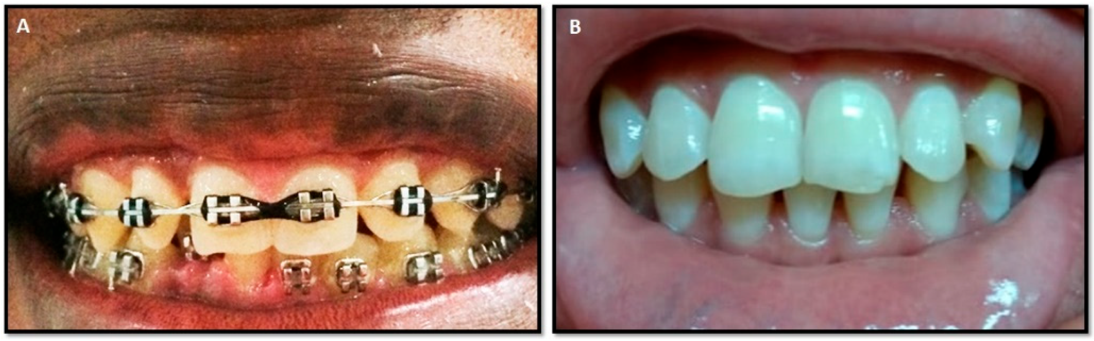 Dentistry 12 00208 g001 Dentistry 12 00208 g001