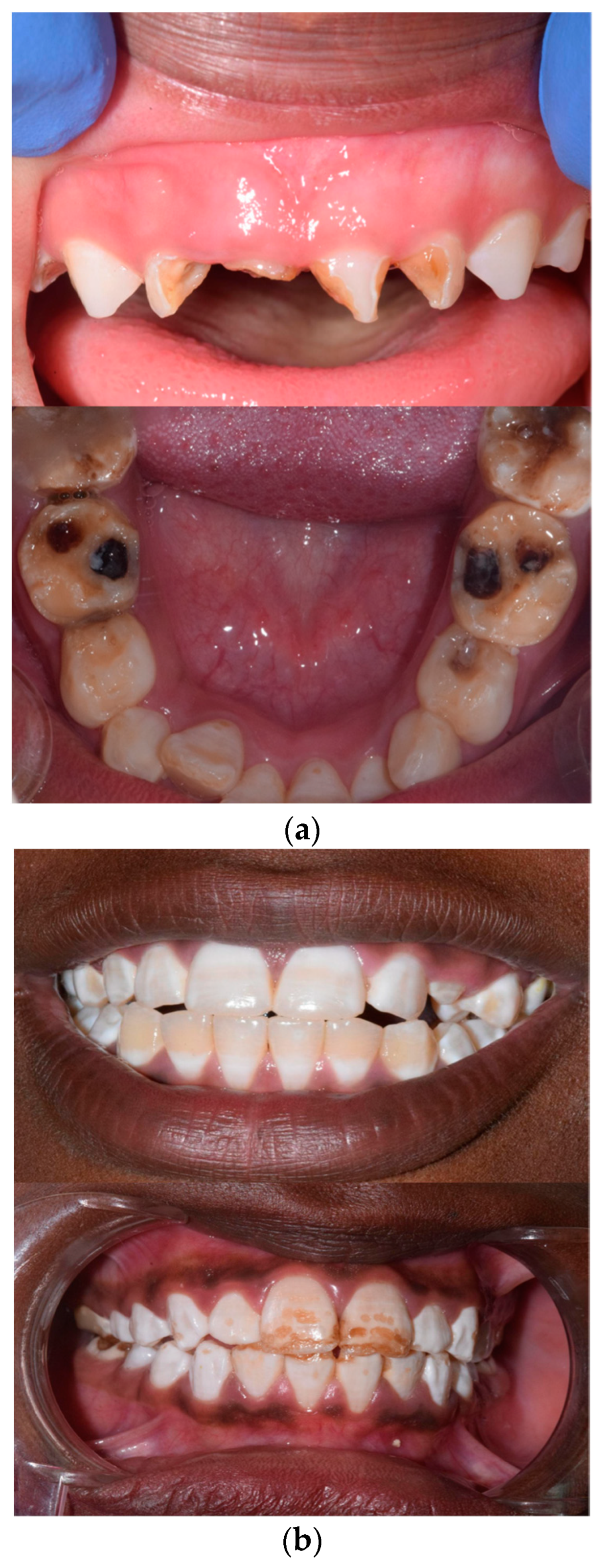 Dentistry 12 00211 g001