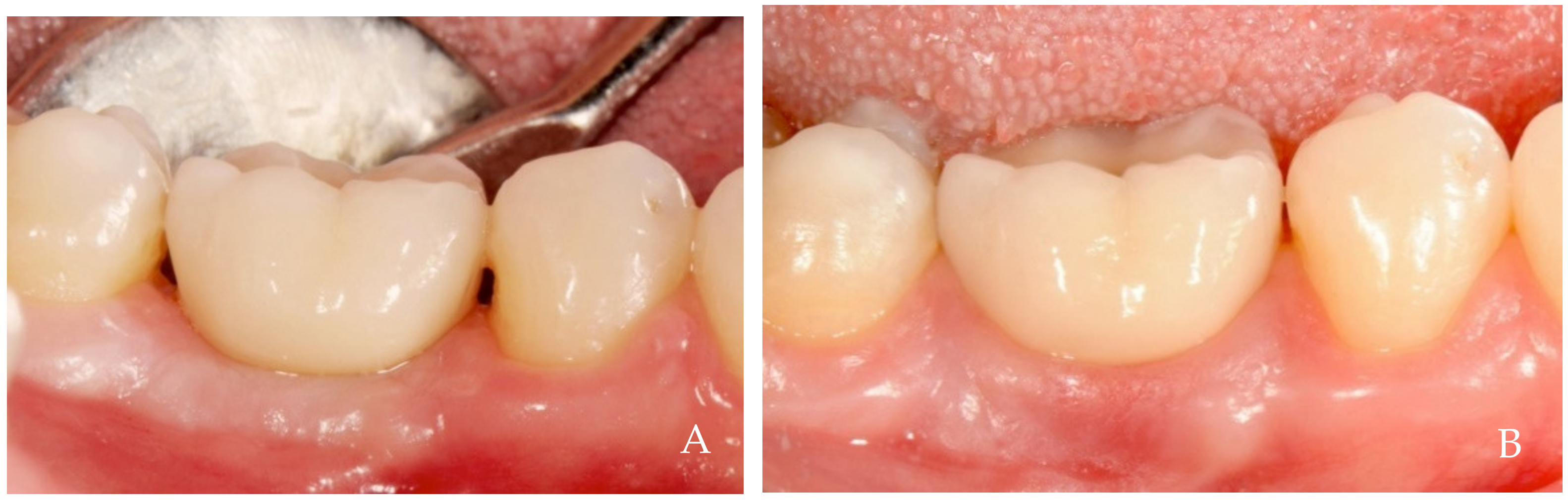 Dentistry 12 00216 g003