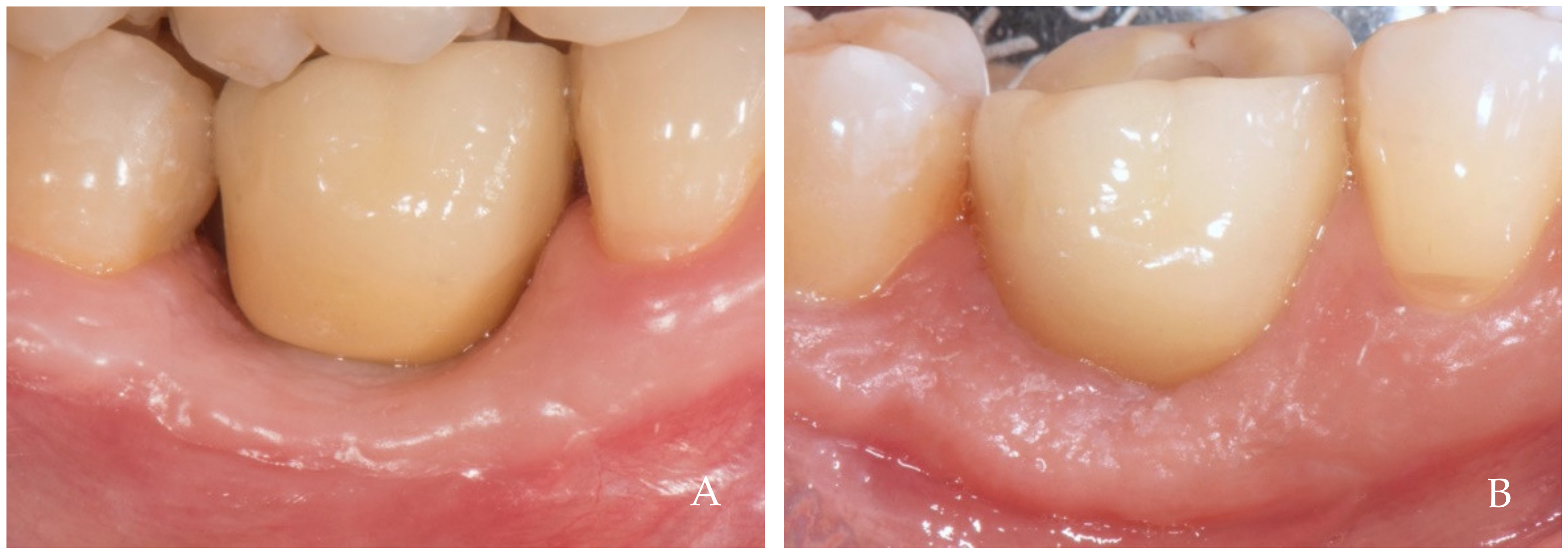 Dentistry 12 00216 g004