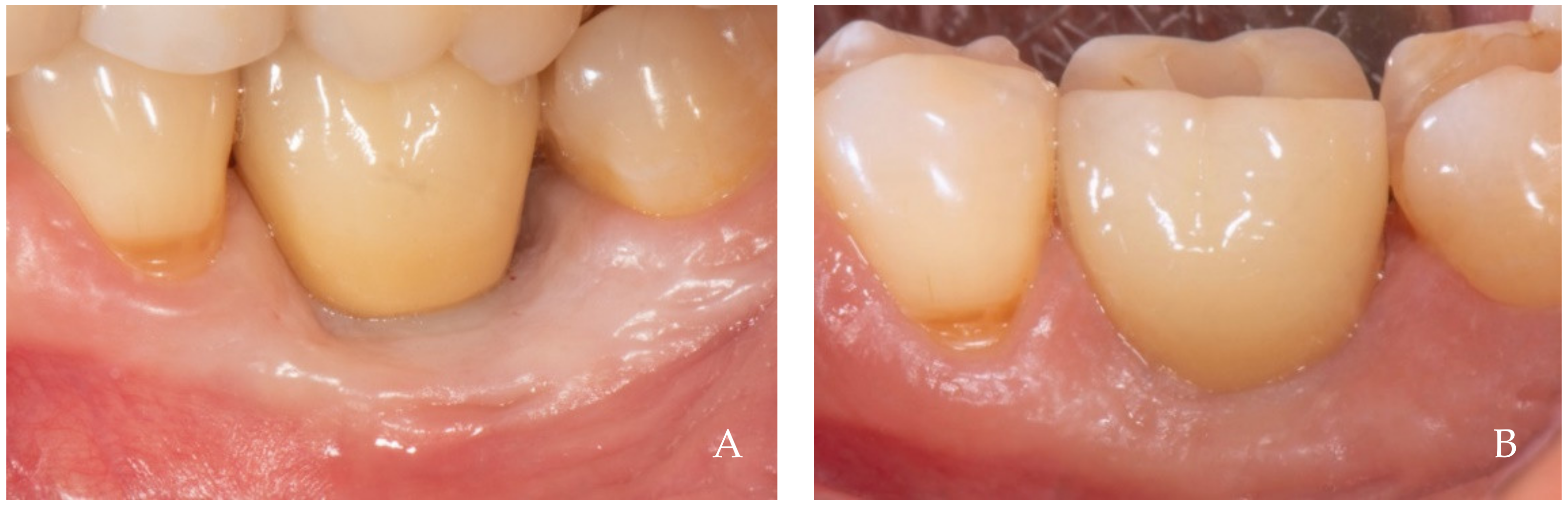 Dentistry 12 00216 g005