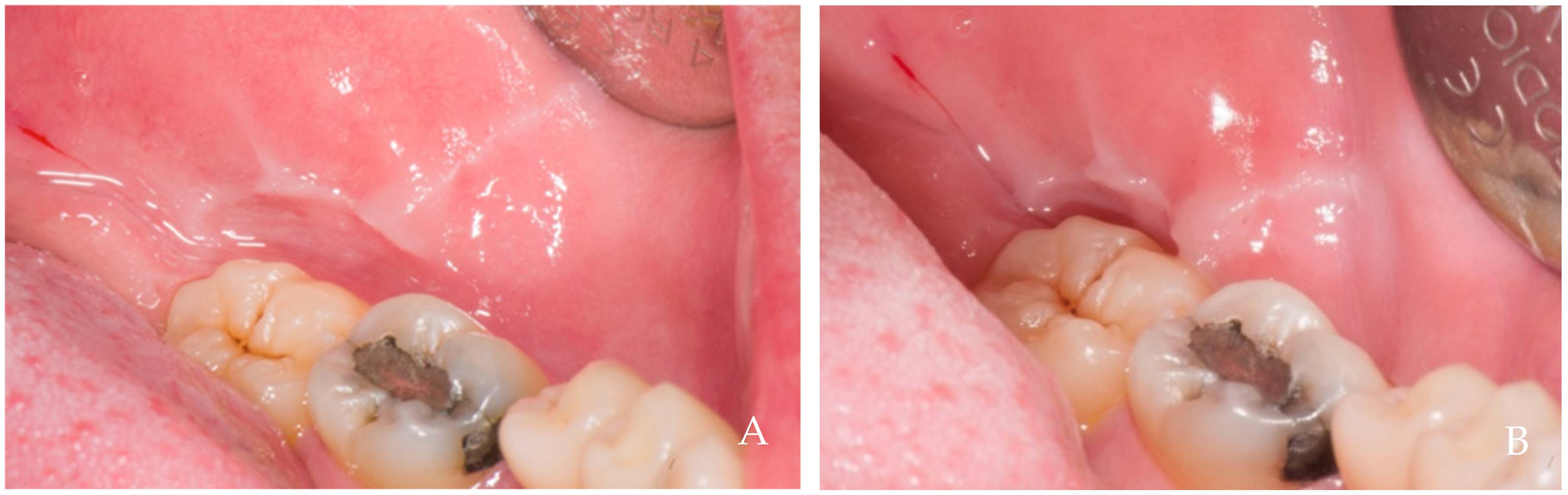 Dentistry 12 00216 g006