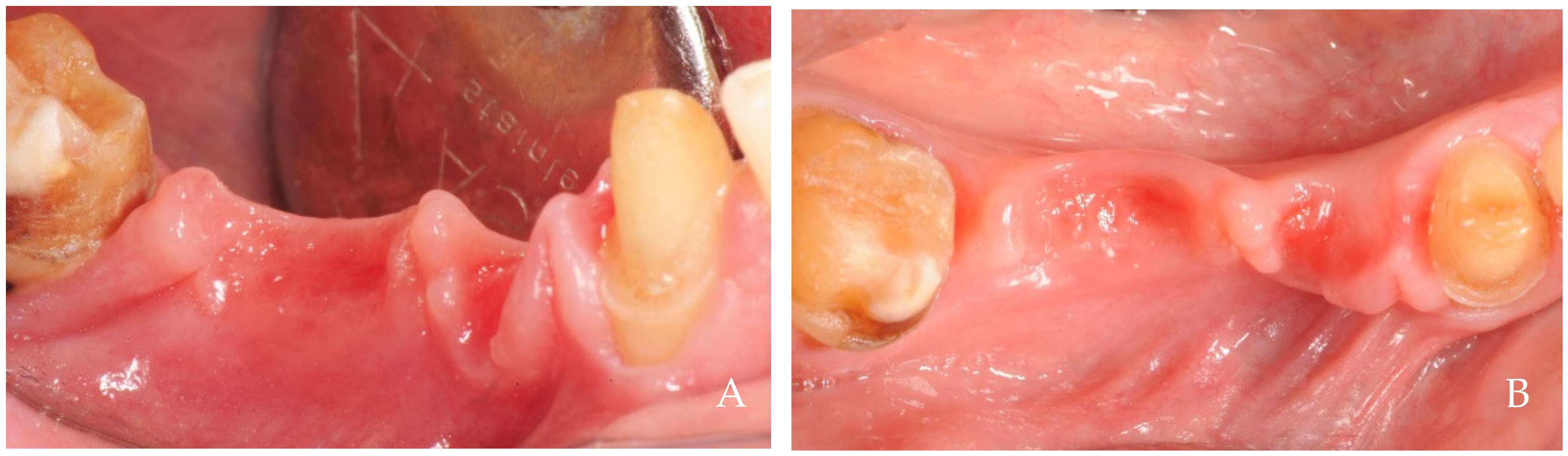 Dentistry 12 00216 g008