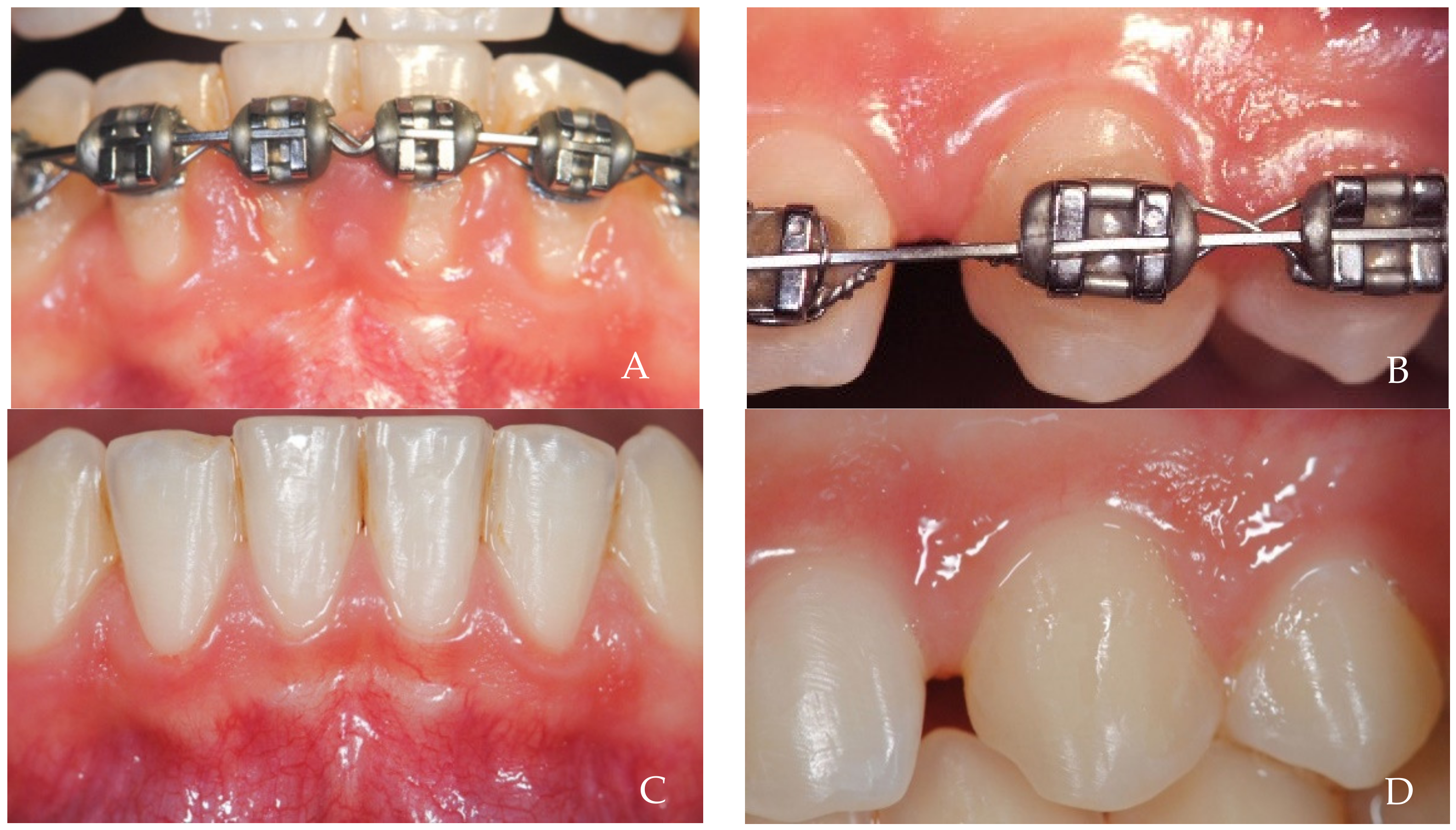 Dentistry 12 00216 g012