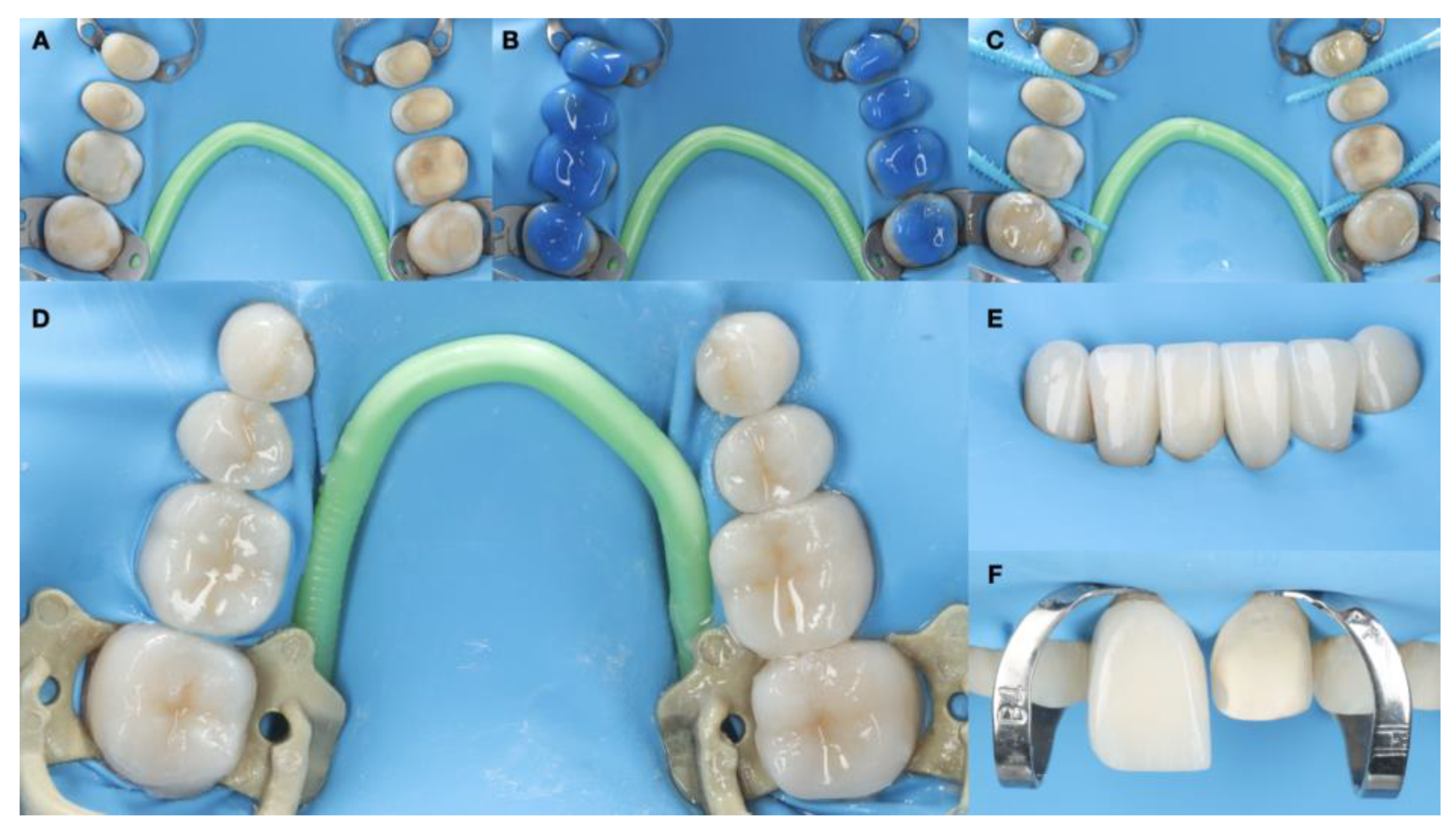 Dentistry 12 00218 g013